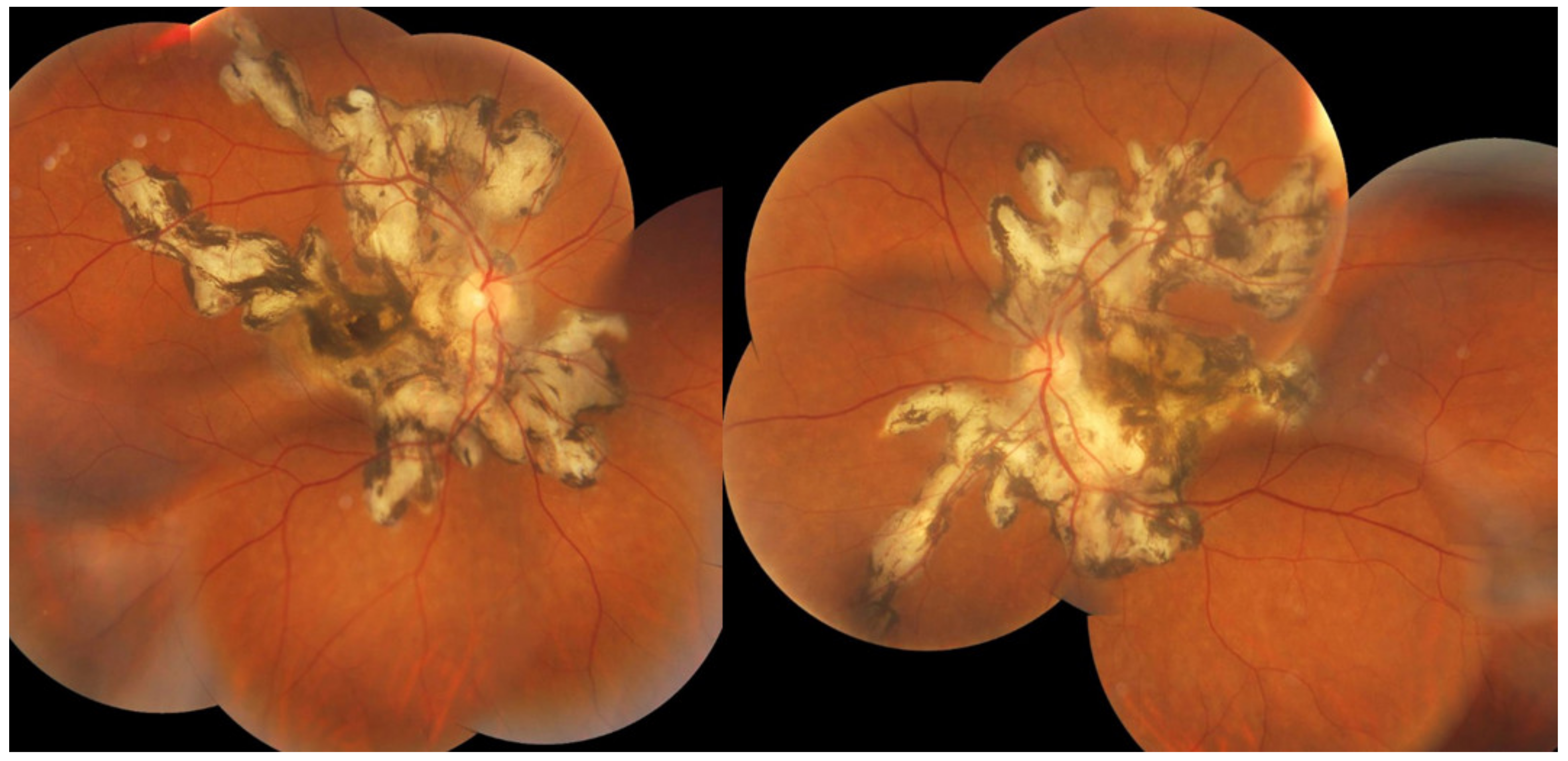 Diagnostics 11 00939 g023 Diagnostics 11 00939 g023