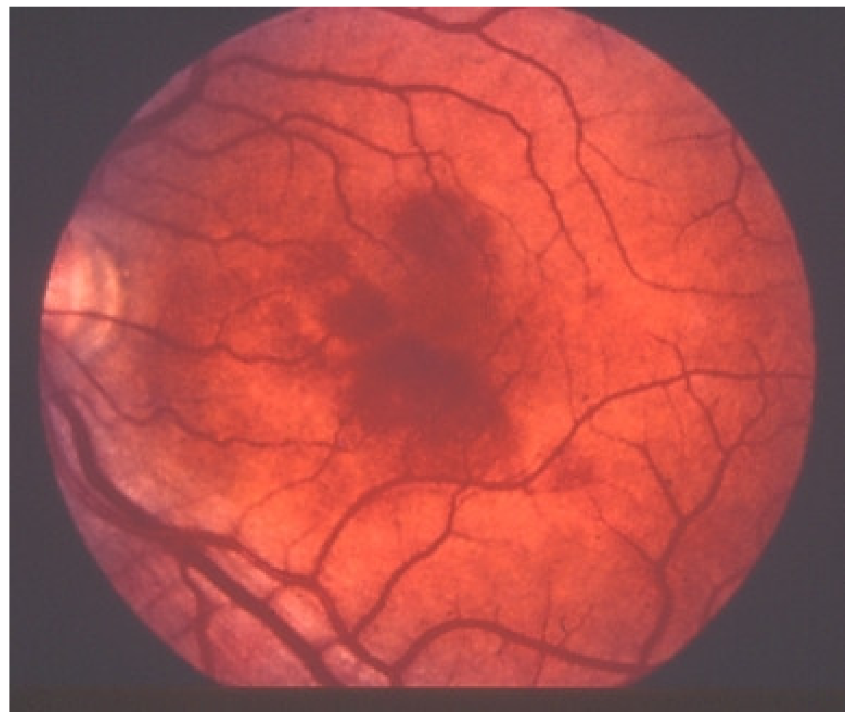 Diagnostics 11 00939 g029 Diagnostics 11 00939 g029