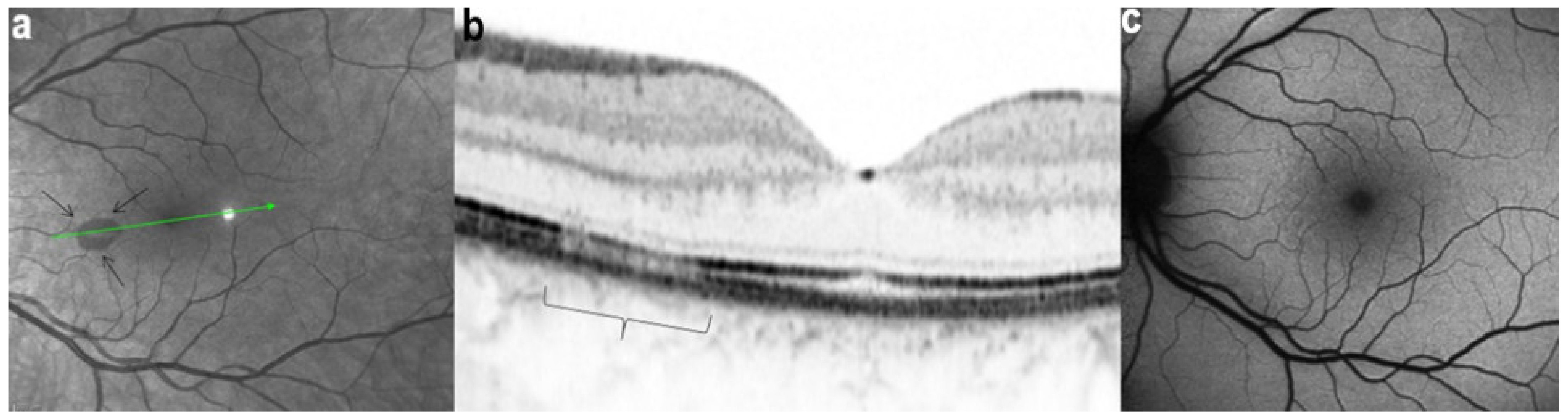 Diagnostics 11 00939 g031 Diagnostics 11 00939 g031