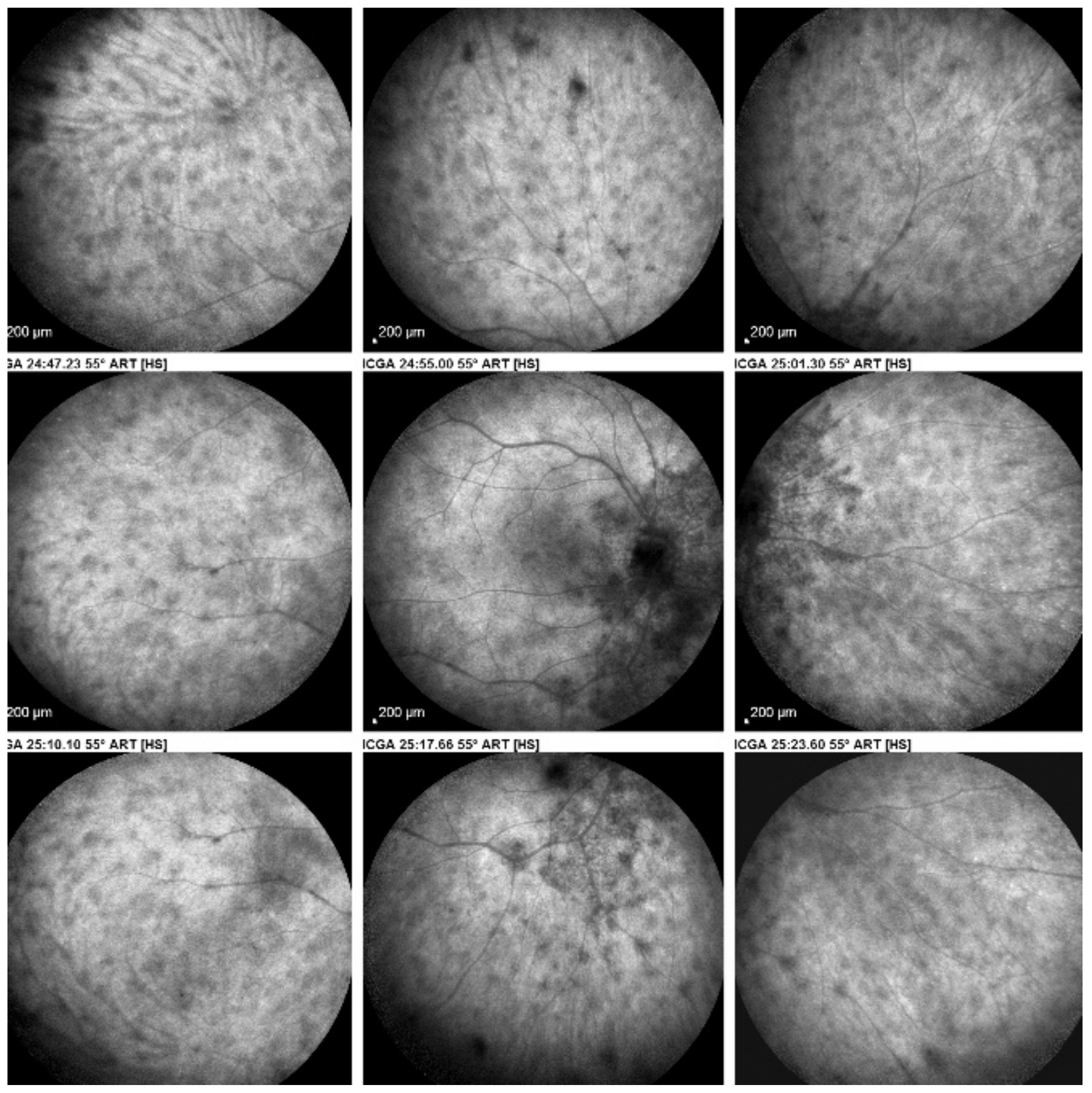 Diagnostics 11 00939 g041 Diagnostics 11 00939 g041