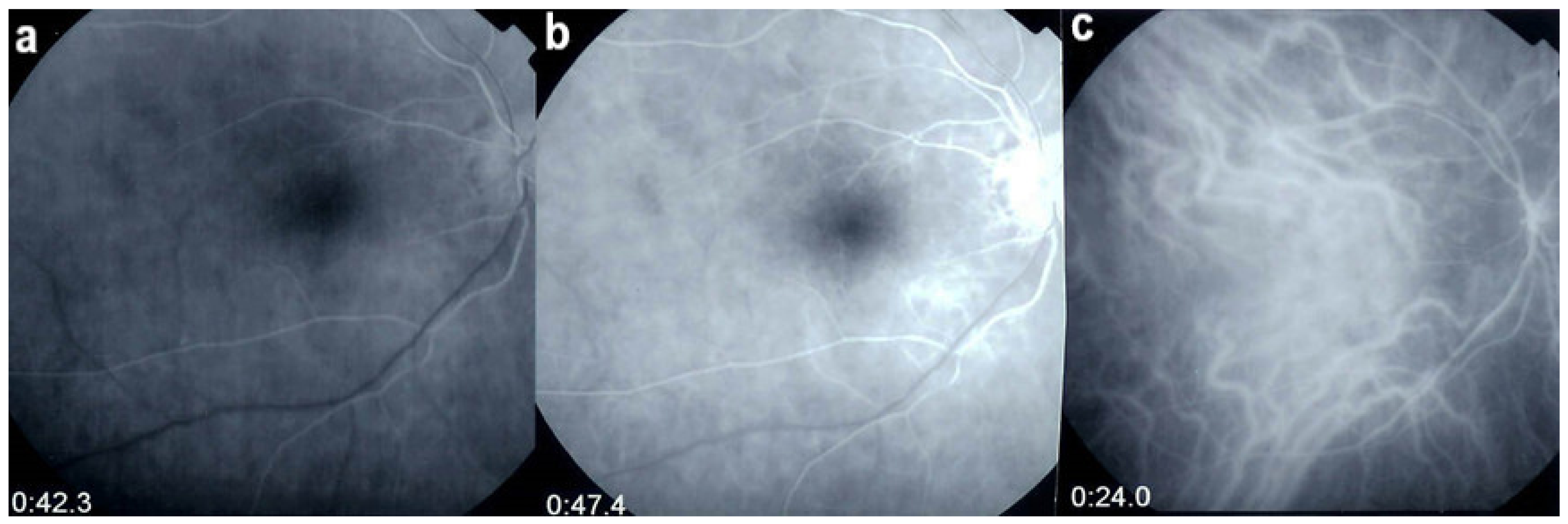 Diagnostics 11 00939 g042 Diagnostics 11 00939 g042