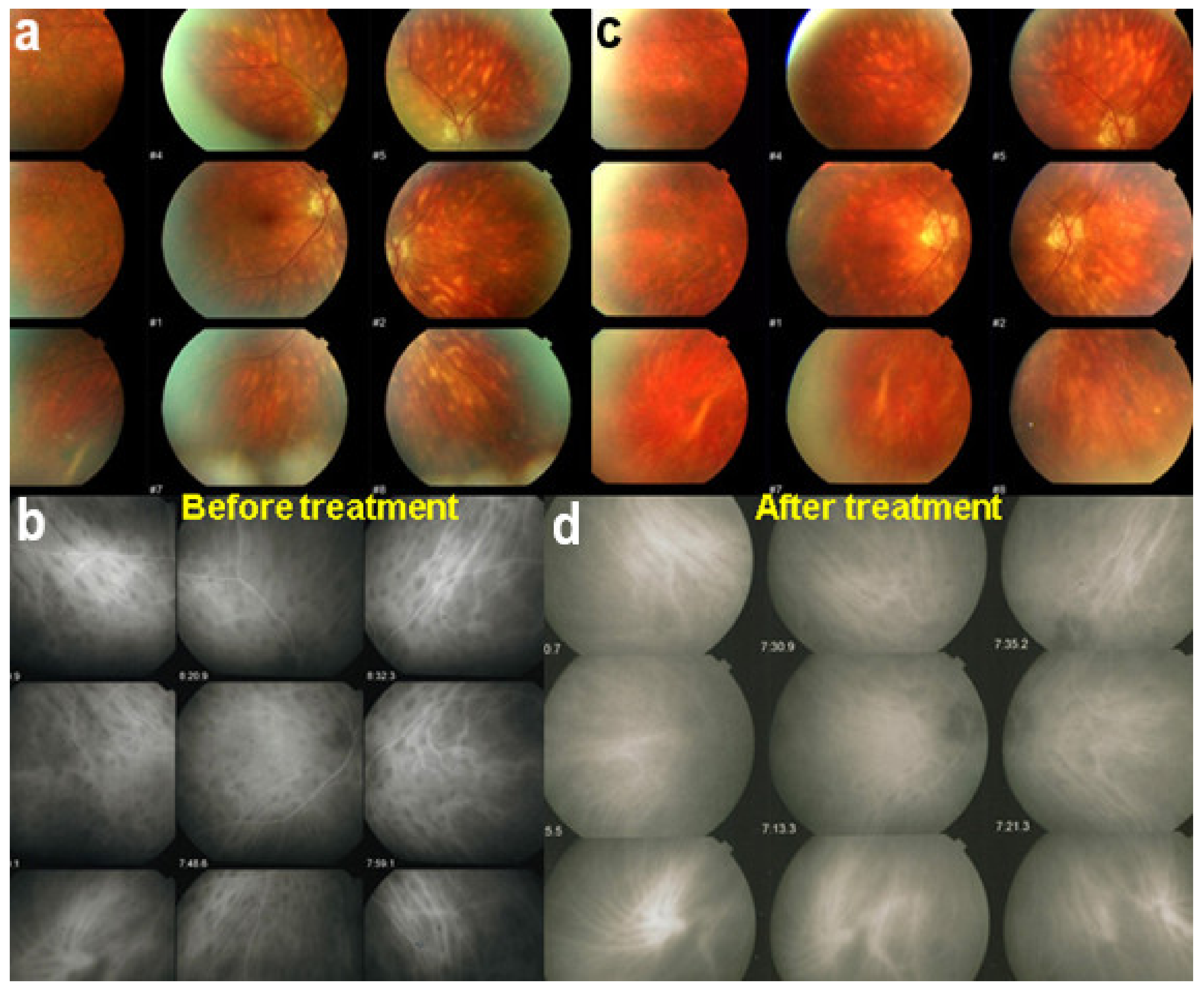 Diagnostics 11 00939 g046 Diagnostics 11 00939 g046