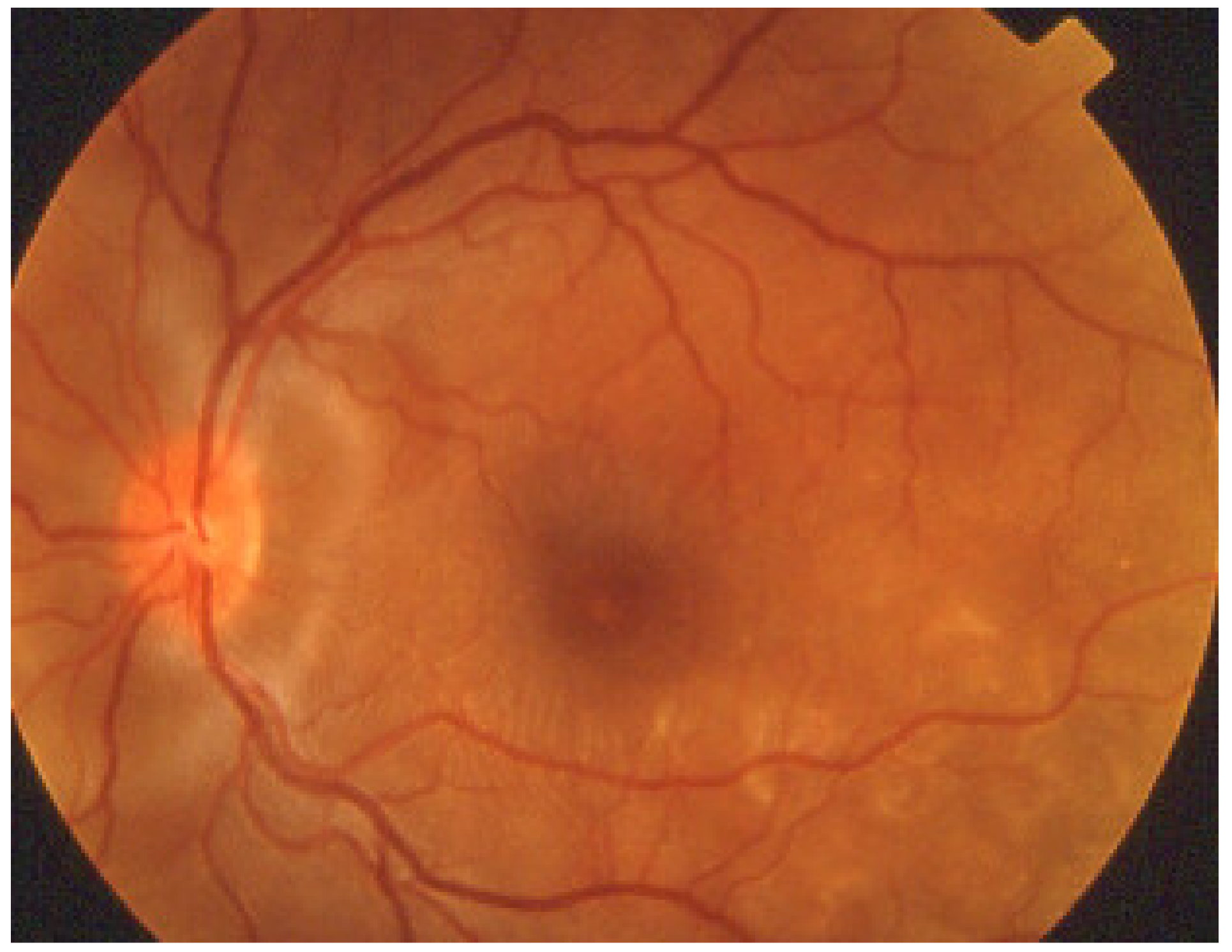 Diagnostics 11 00939 g047 Diagnostics 11 00939 g047