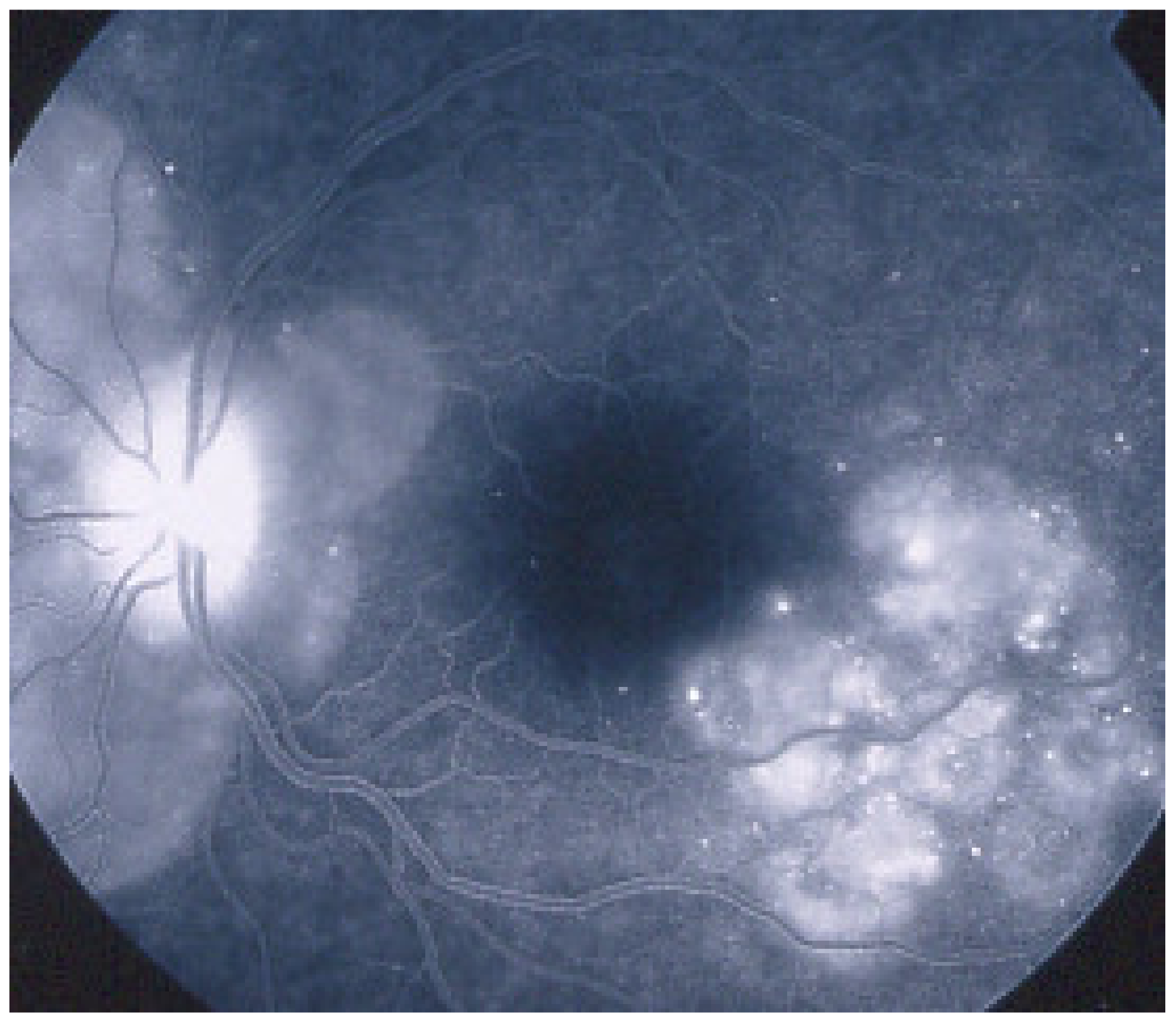 Diagnostics 11 00939 g048 Diagnostics 11 00939 g048