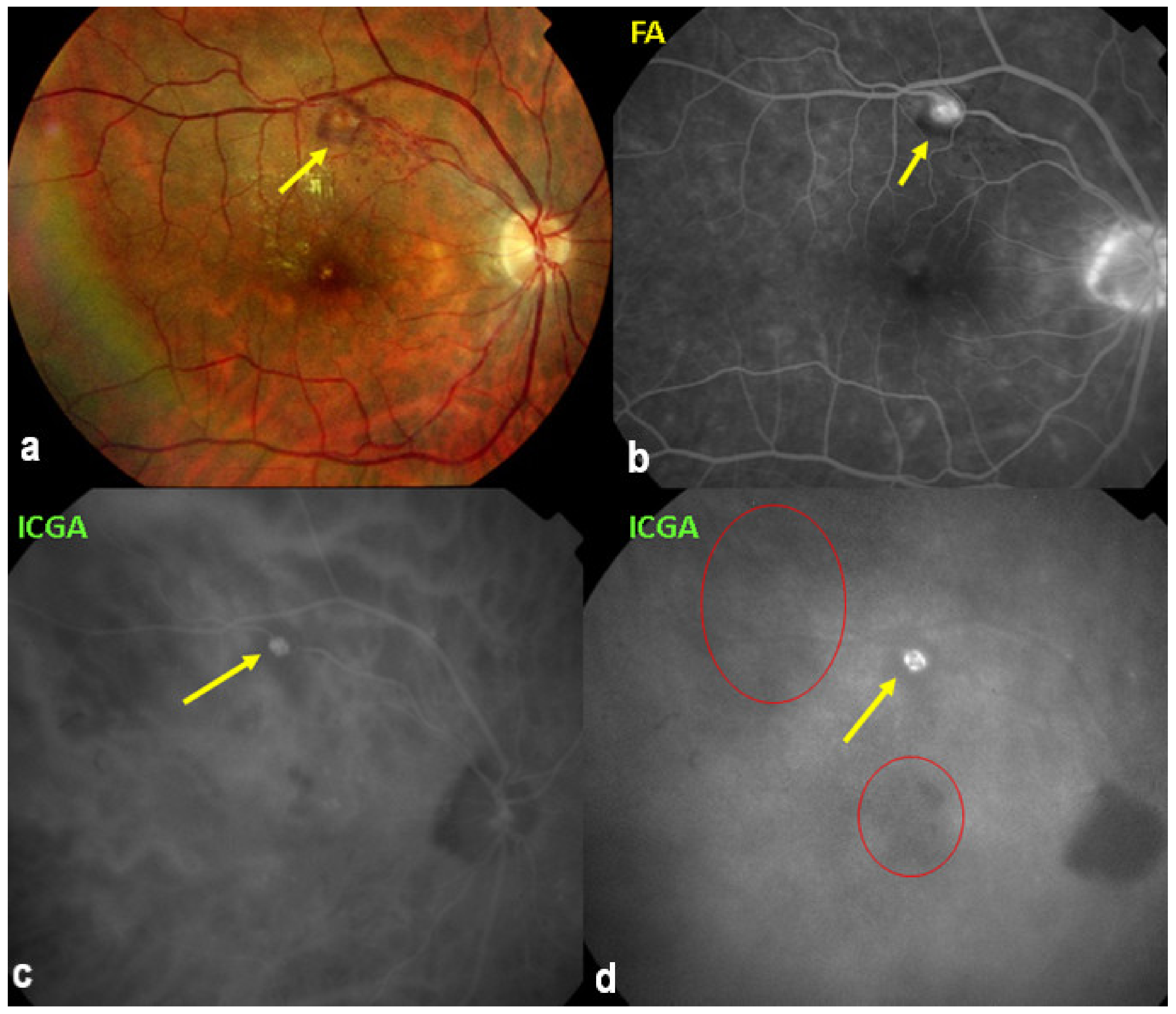 Diagnostics 11 00939 g053 Diagnostics 11 00939 g053