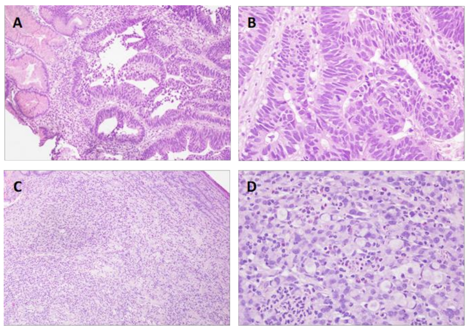 Diagnostics 11 00944 g001