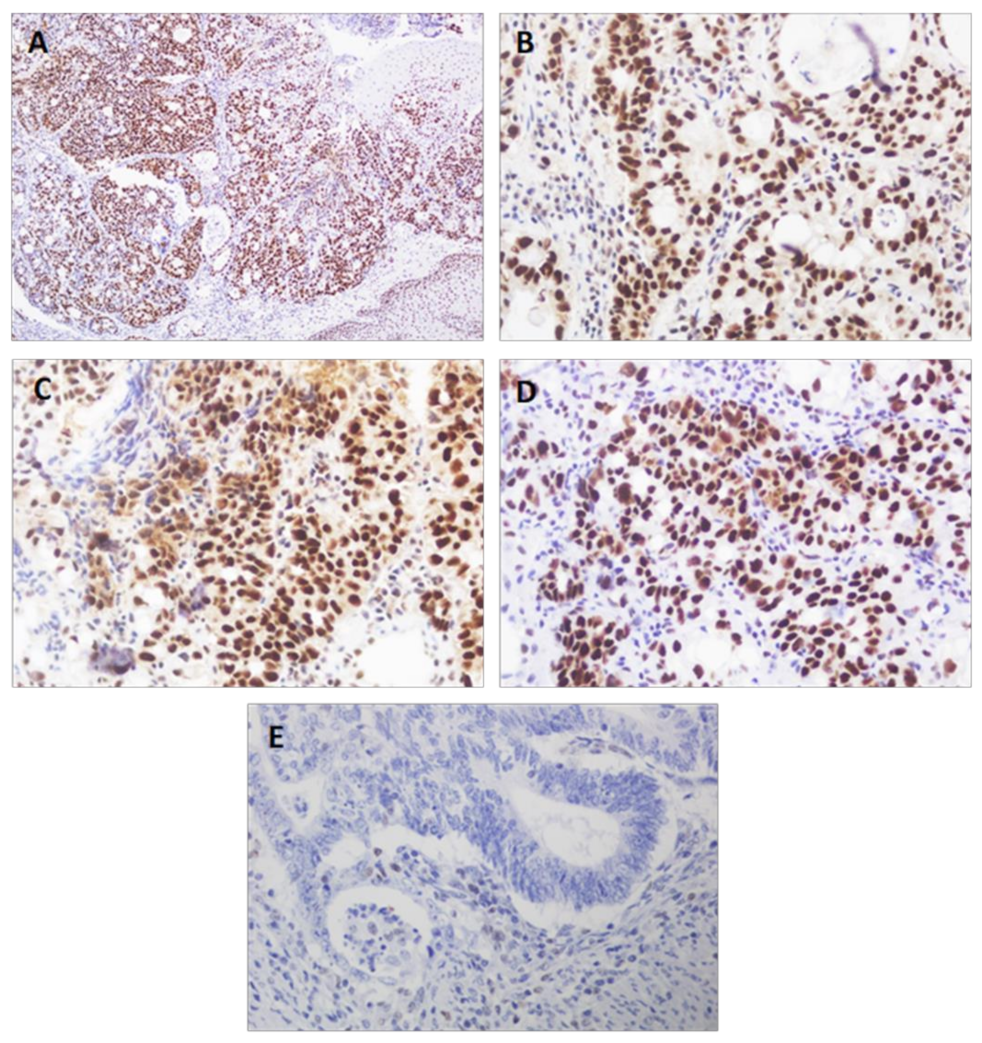 Diagnostics 11 00944 g003