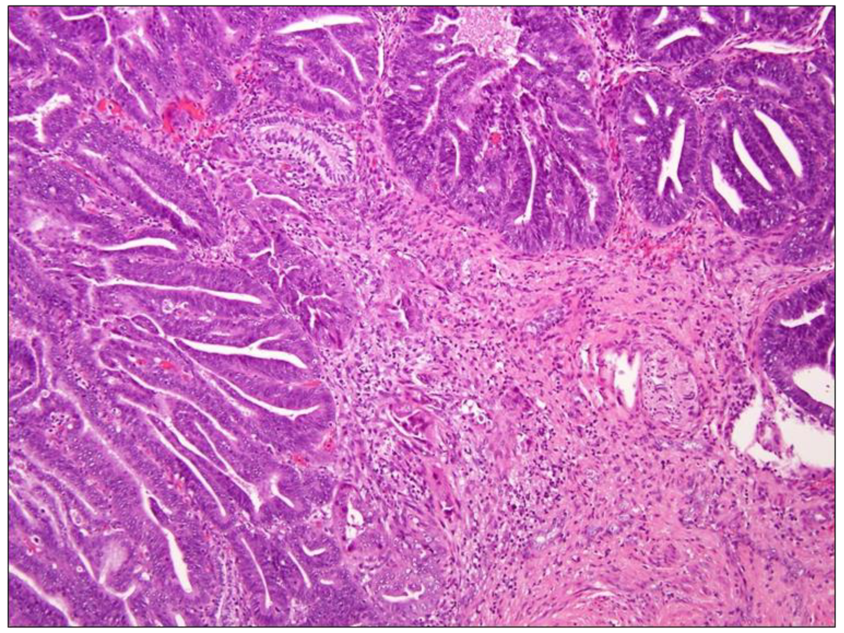 Diagnostics 11 00952 g003