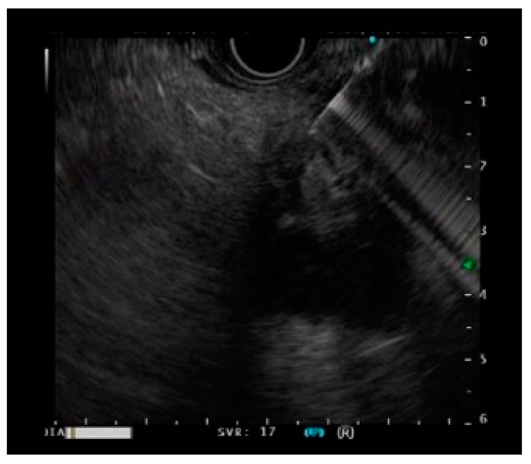 Diagnostics 11 00965 g001