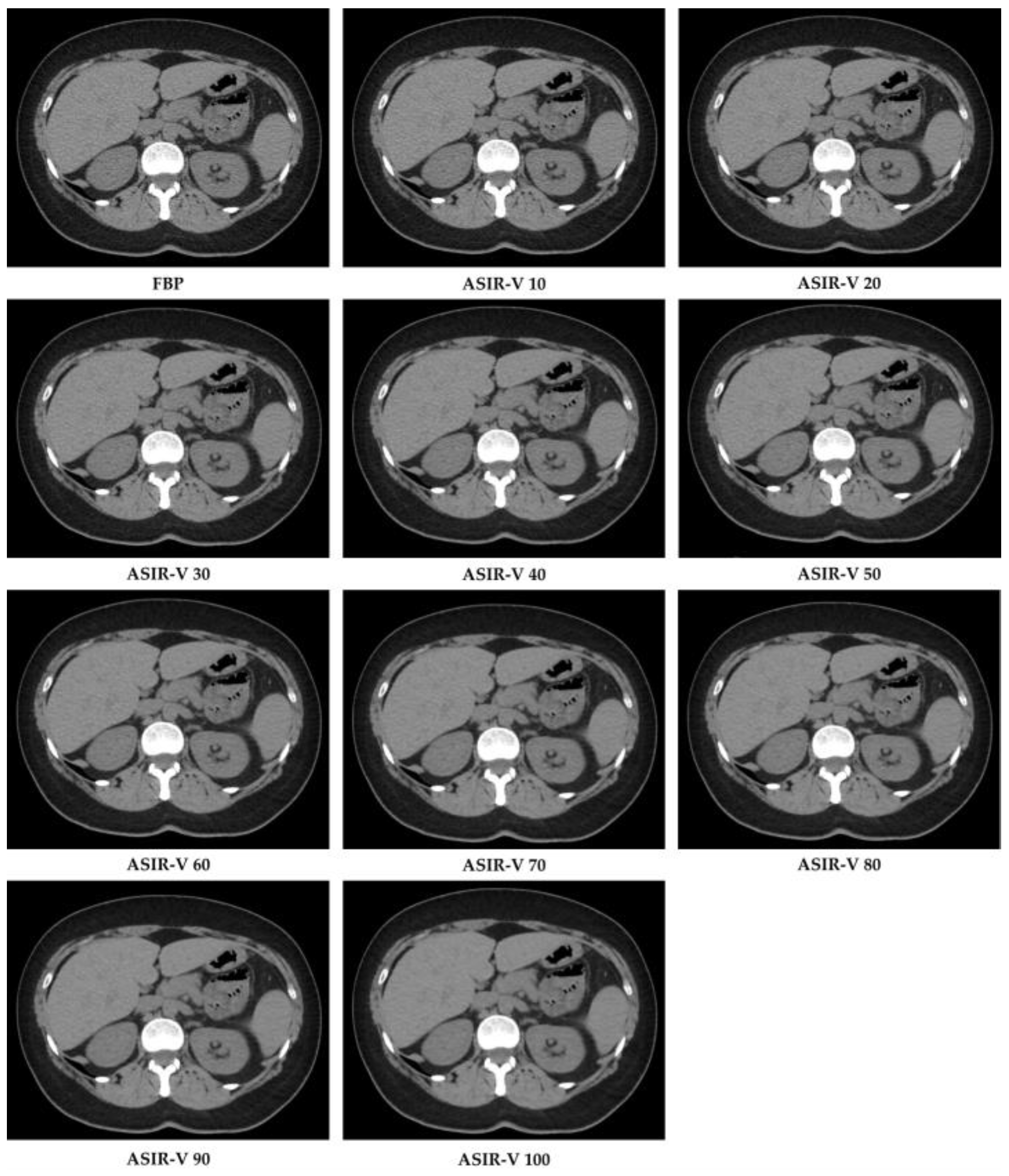 Diagnostics 11 01000 g002