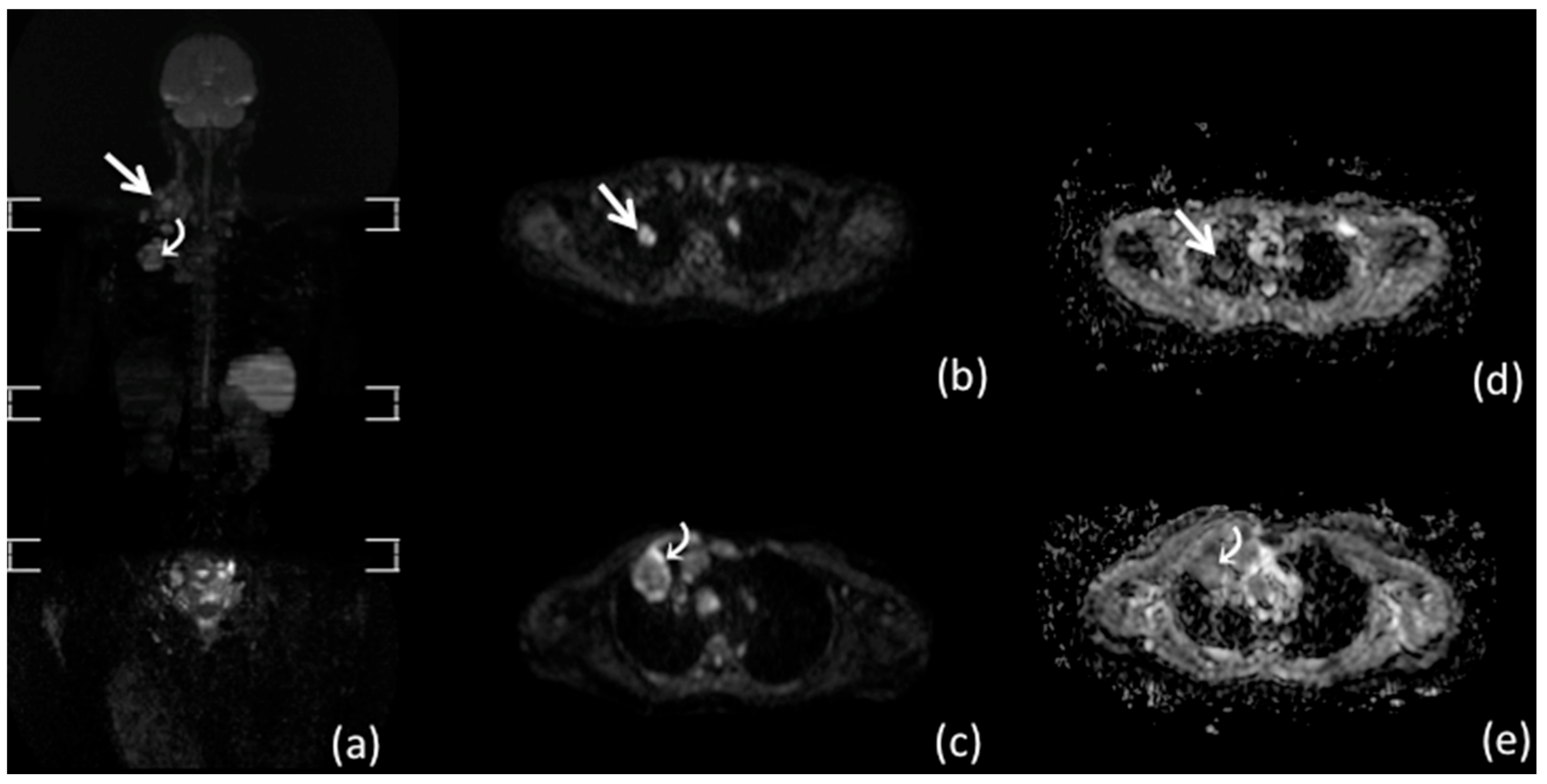 Diagnostics 11 01007 g001