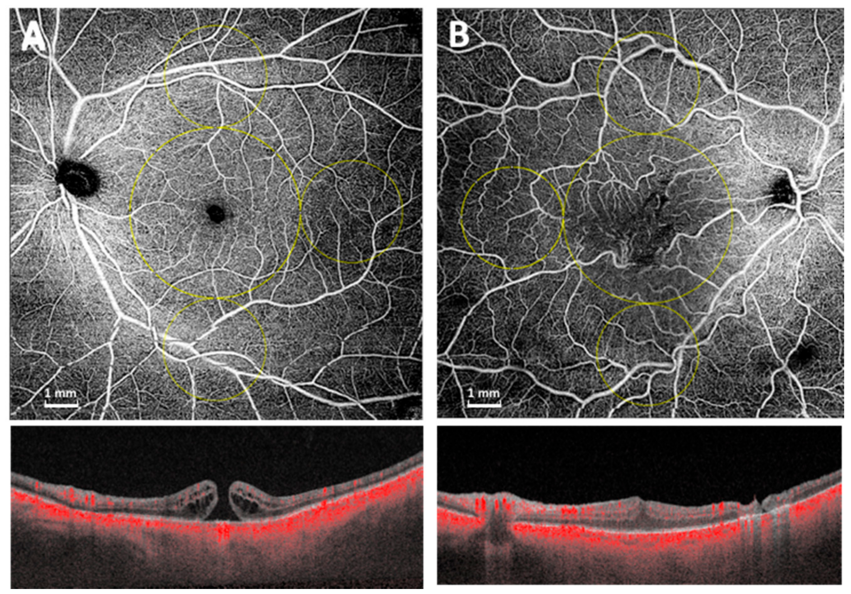 Diagnostics 11 01031 g001