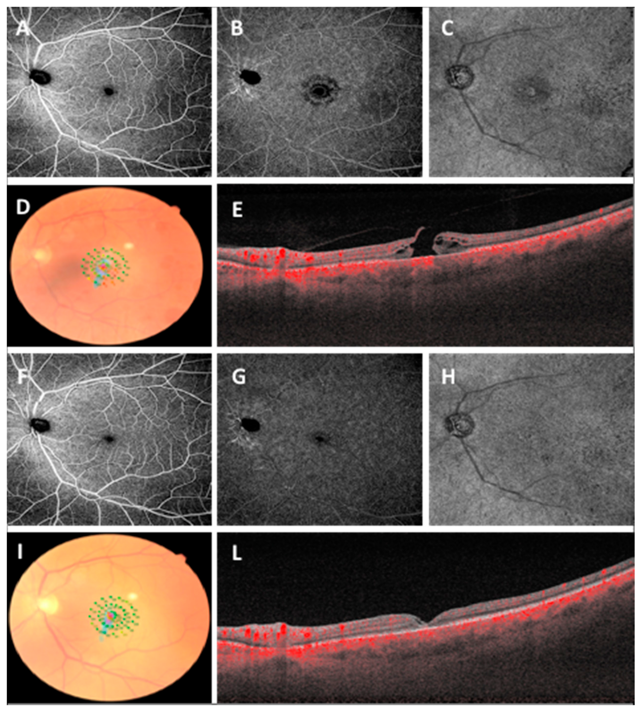 Diagnostics 11 01031 g002