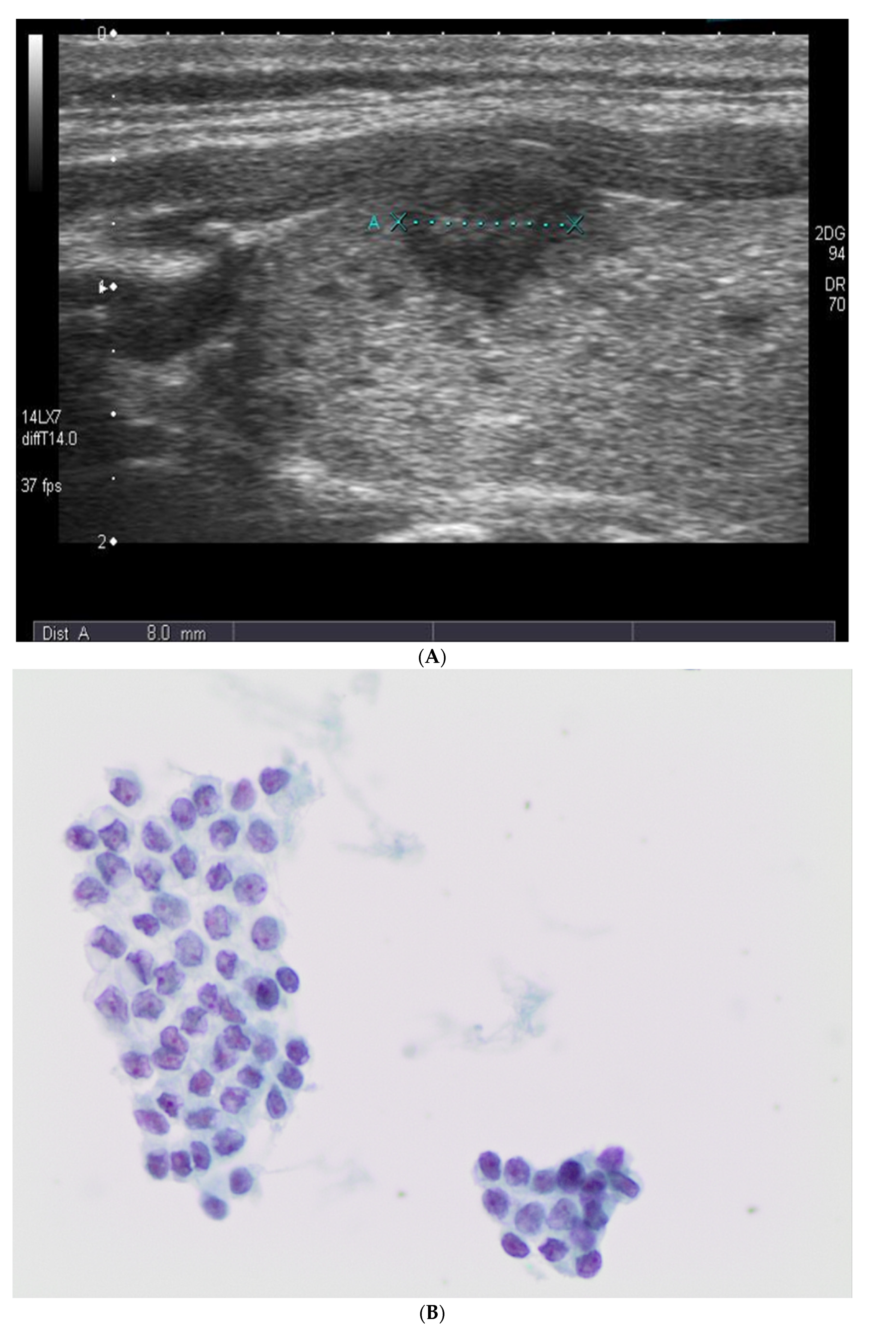 Diagnostics 11 01043 g001a