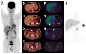 Diagnostics 11 01045 i001
