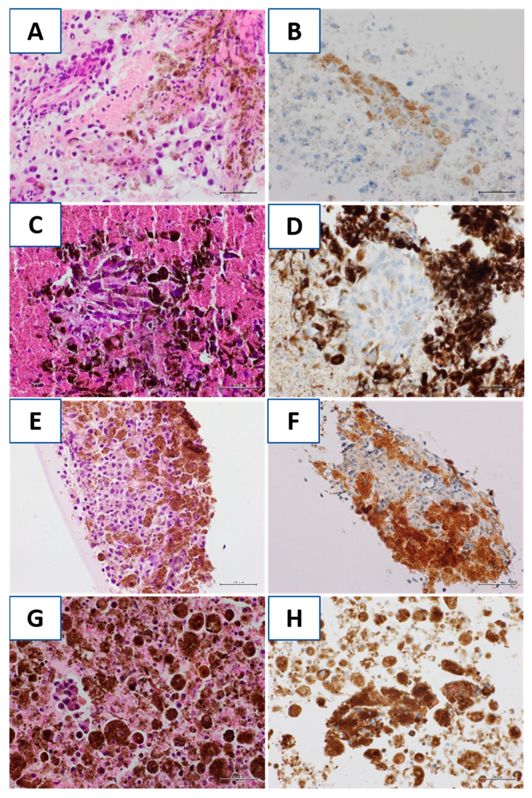 Diagnostics 11 01110 g004 Diagnostics 11 01110 g004