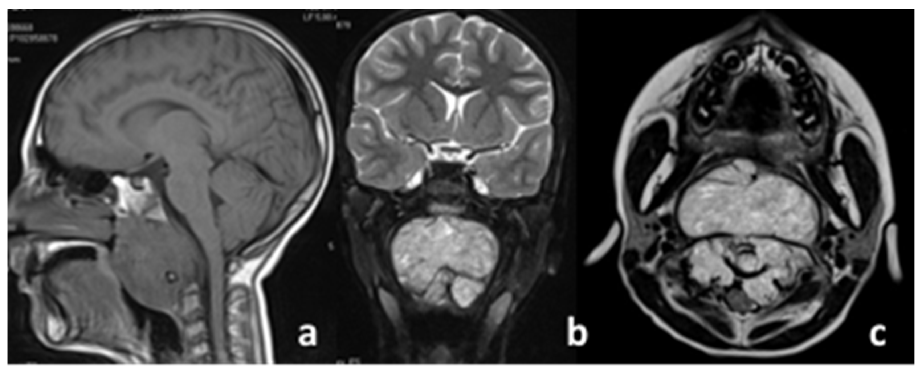 Diagnostics 11 01117 g001