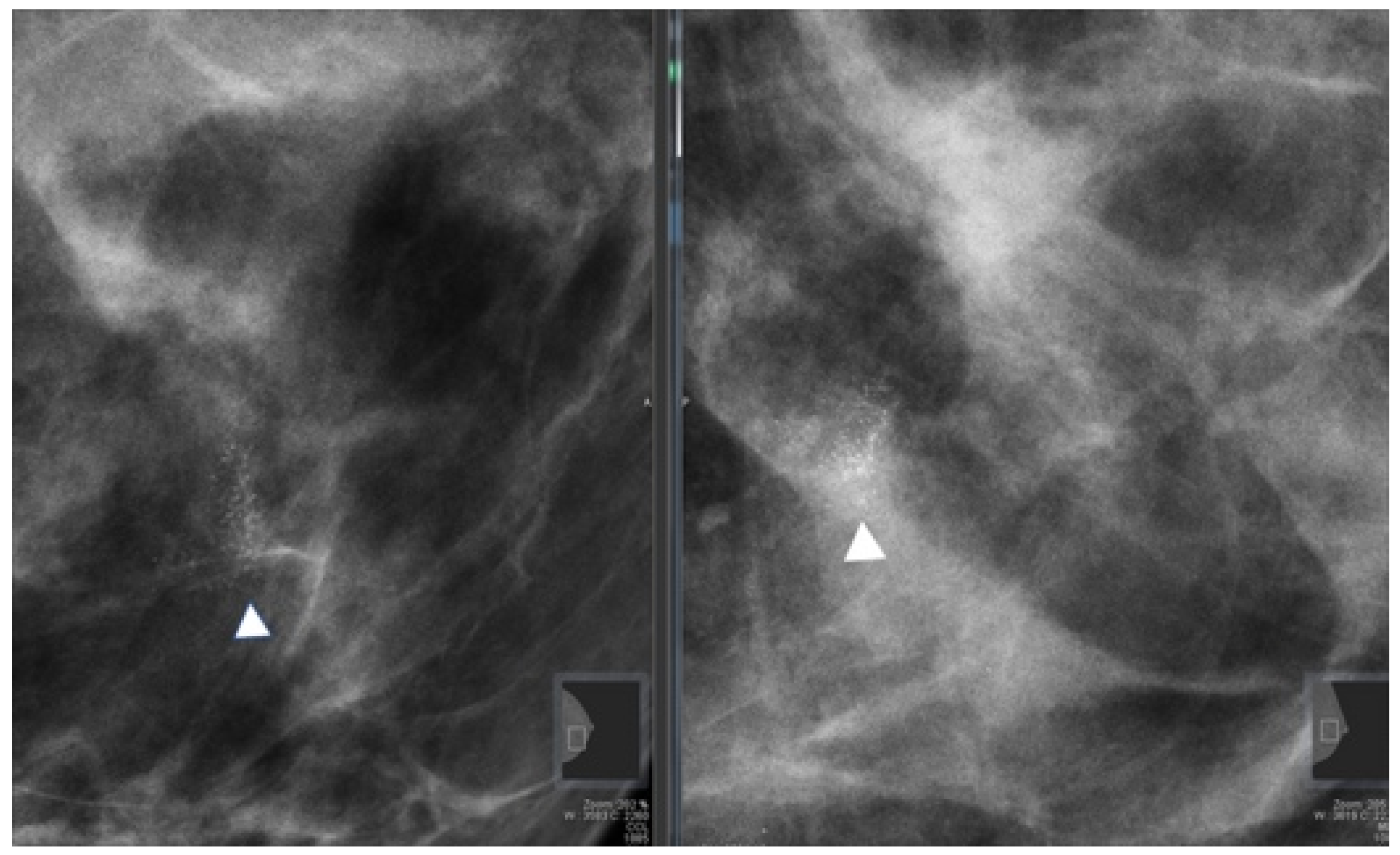 Diagnostics 11 01120 g002 Diagnostics 11 01120 g002