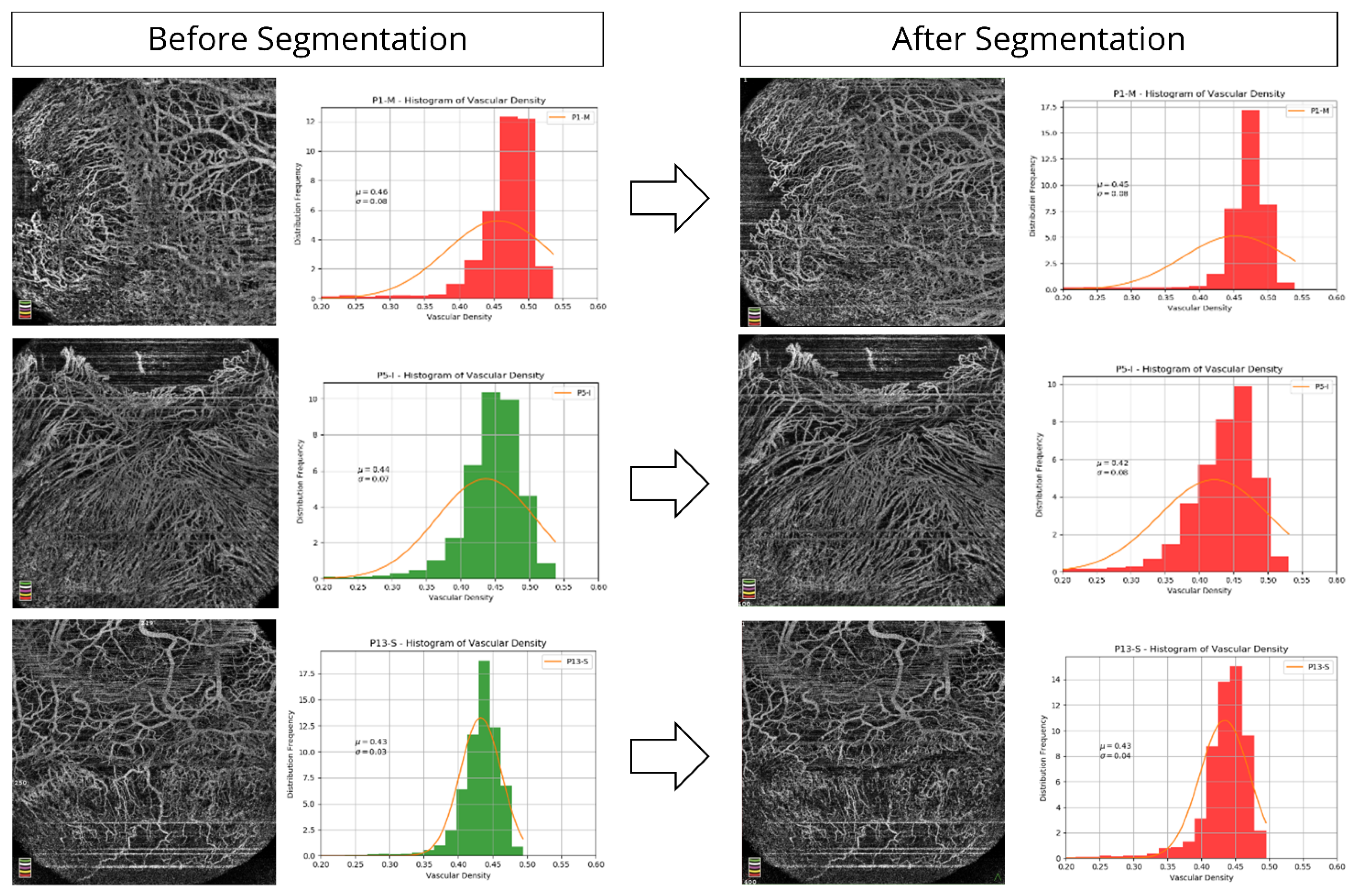 Diagnostics 11 01130 g004