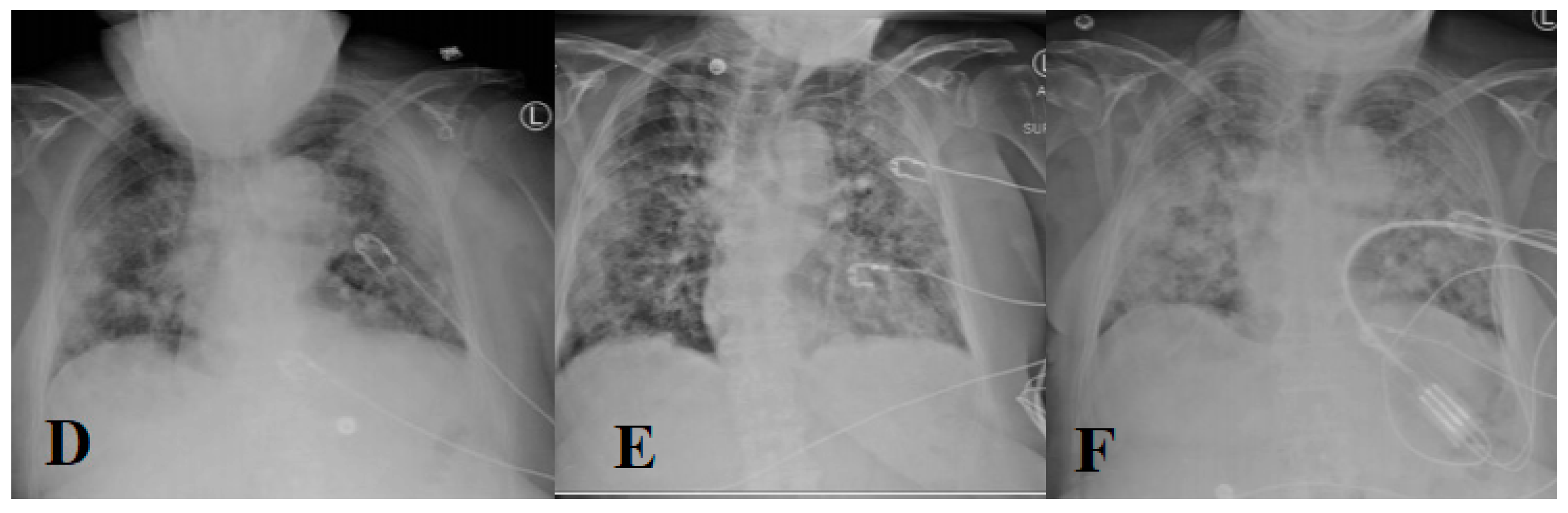 Diagnostics 11 01155 g005b