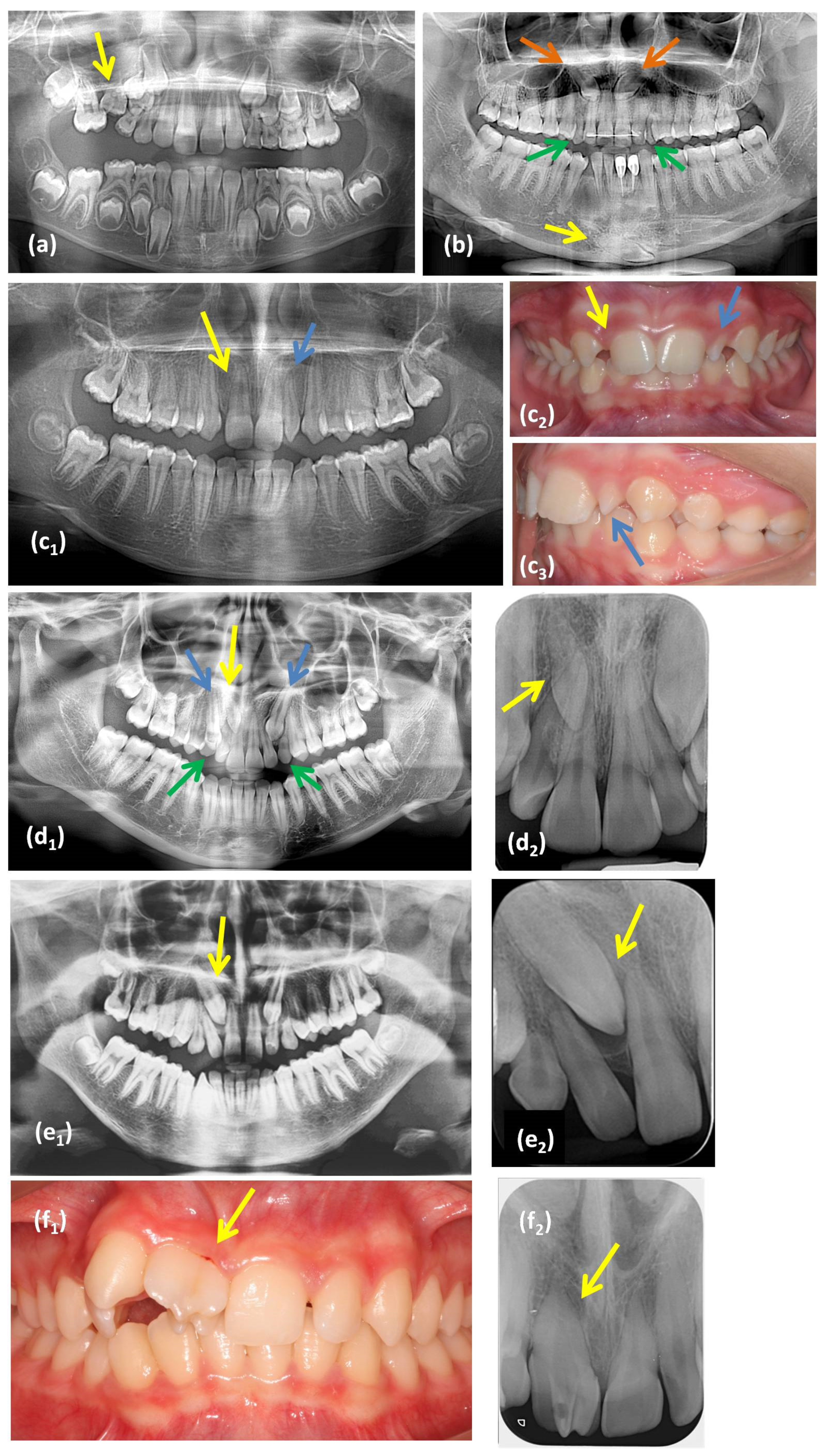 Diagnostics 11 01161 g001 Diagnostics 11 01161 g001