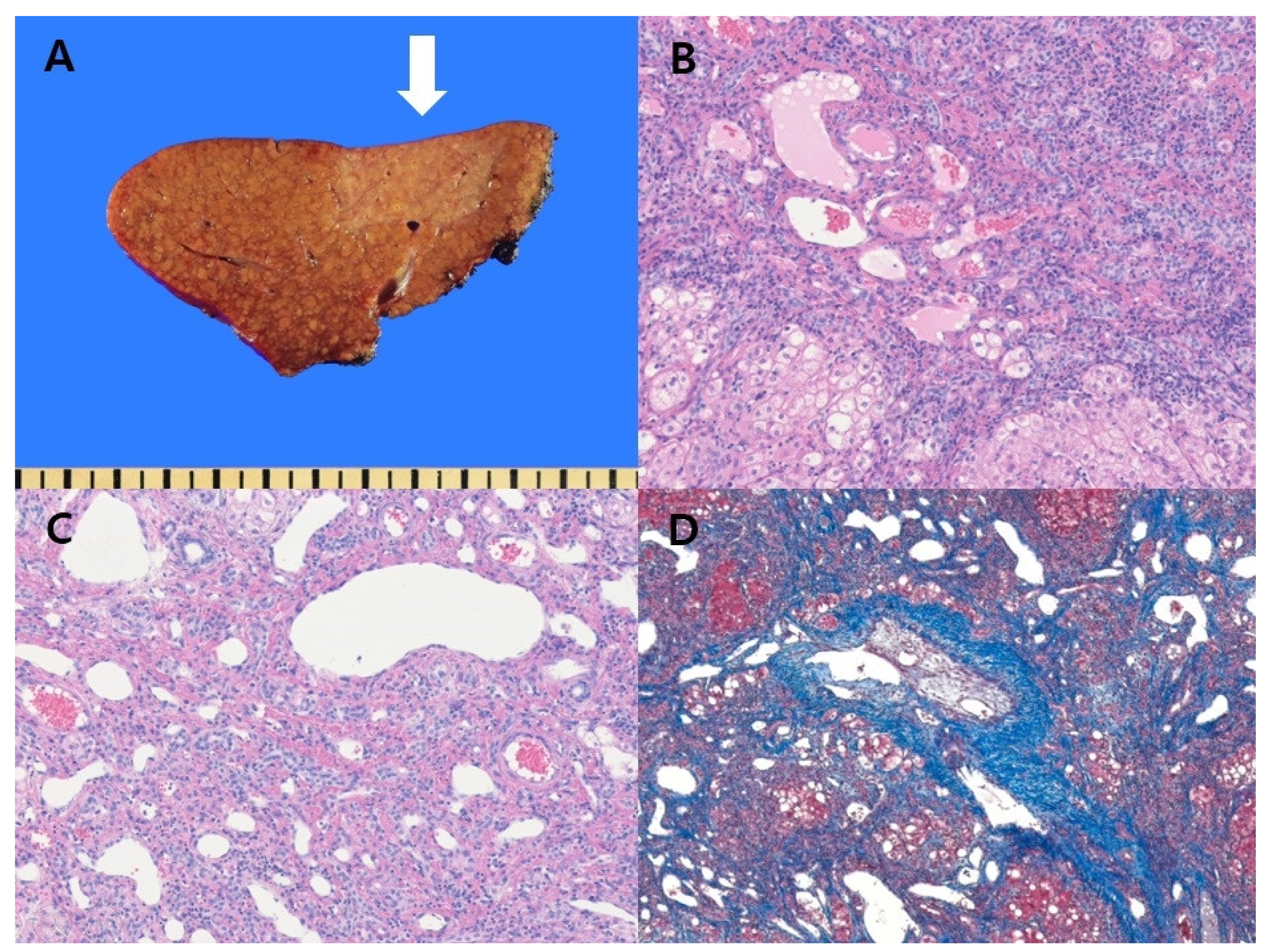 Diagnostics 11 01171 g002