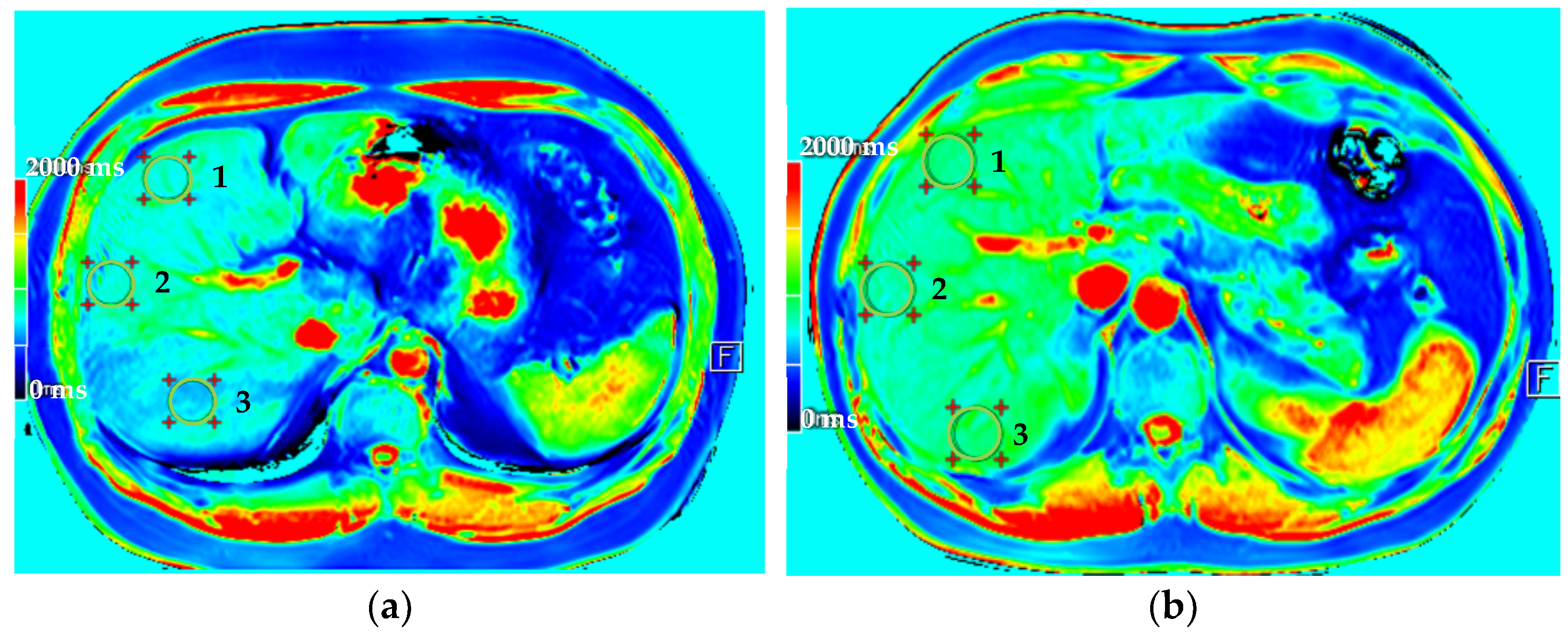 Diagnostics 11 01178 g004