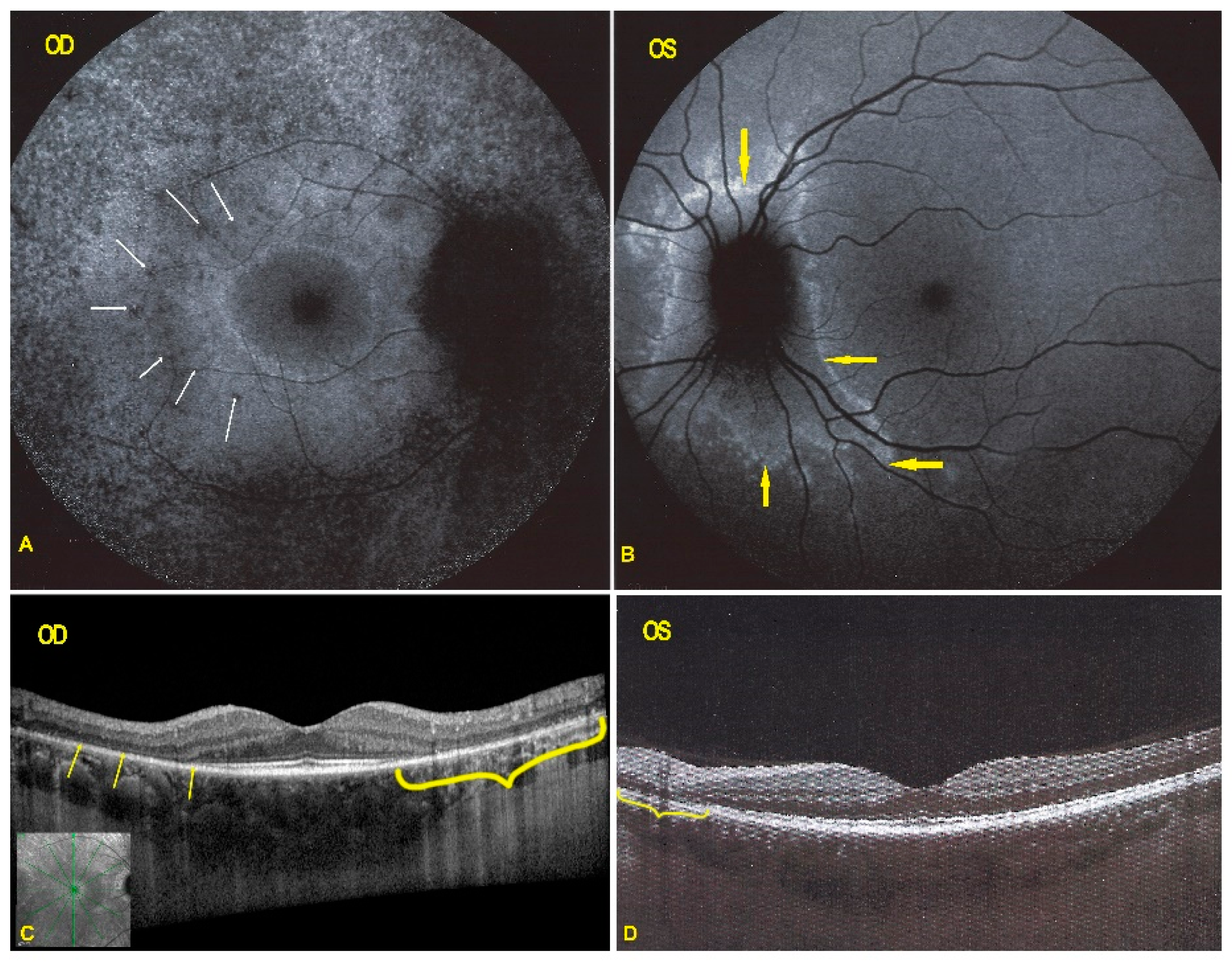 Diagnostics 11 01184 g006