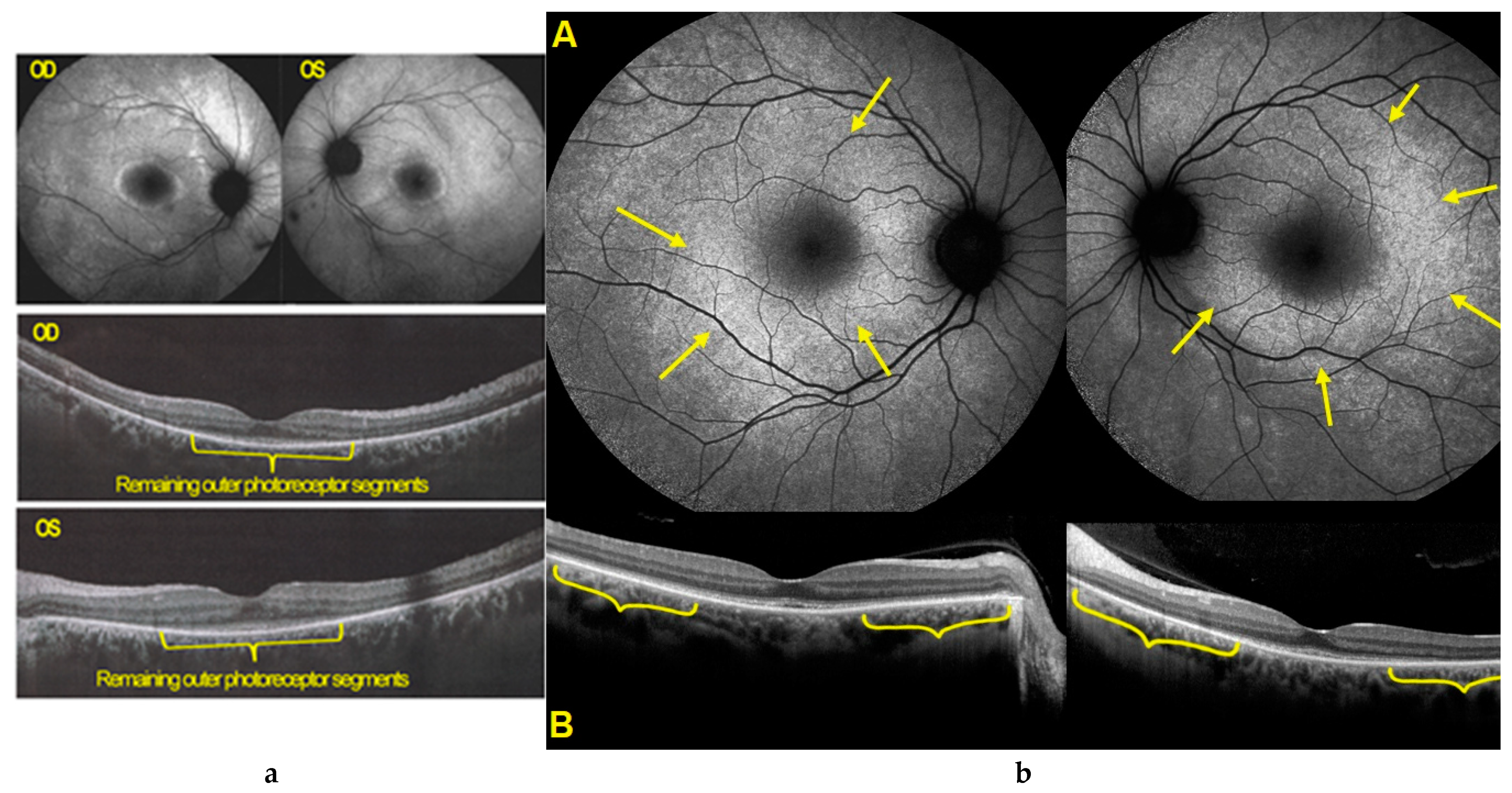 Diagnostics 11 01184 g011