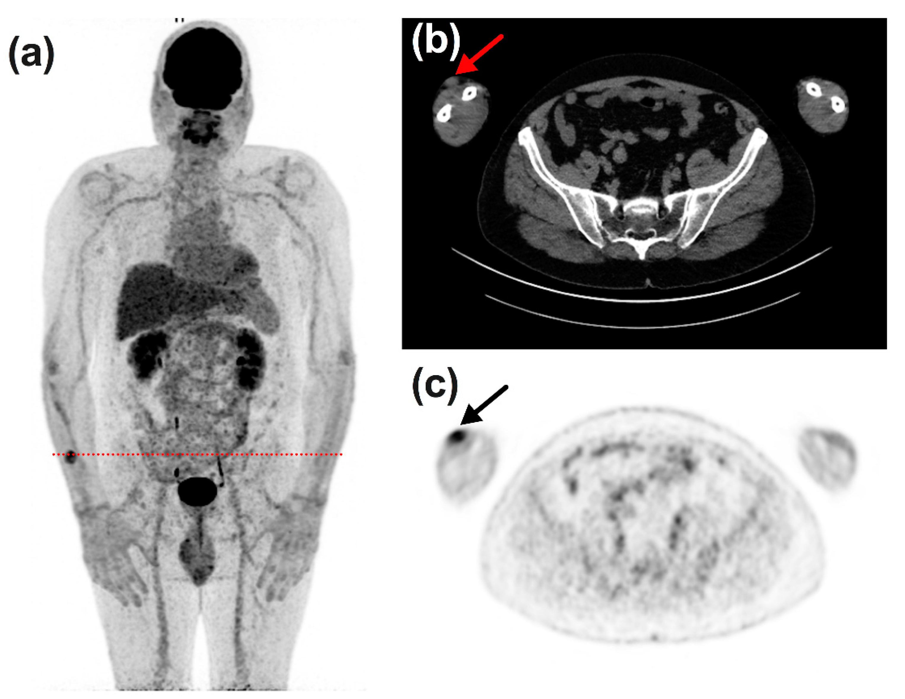 Diagnostics 11 01198 g006