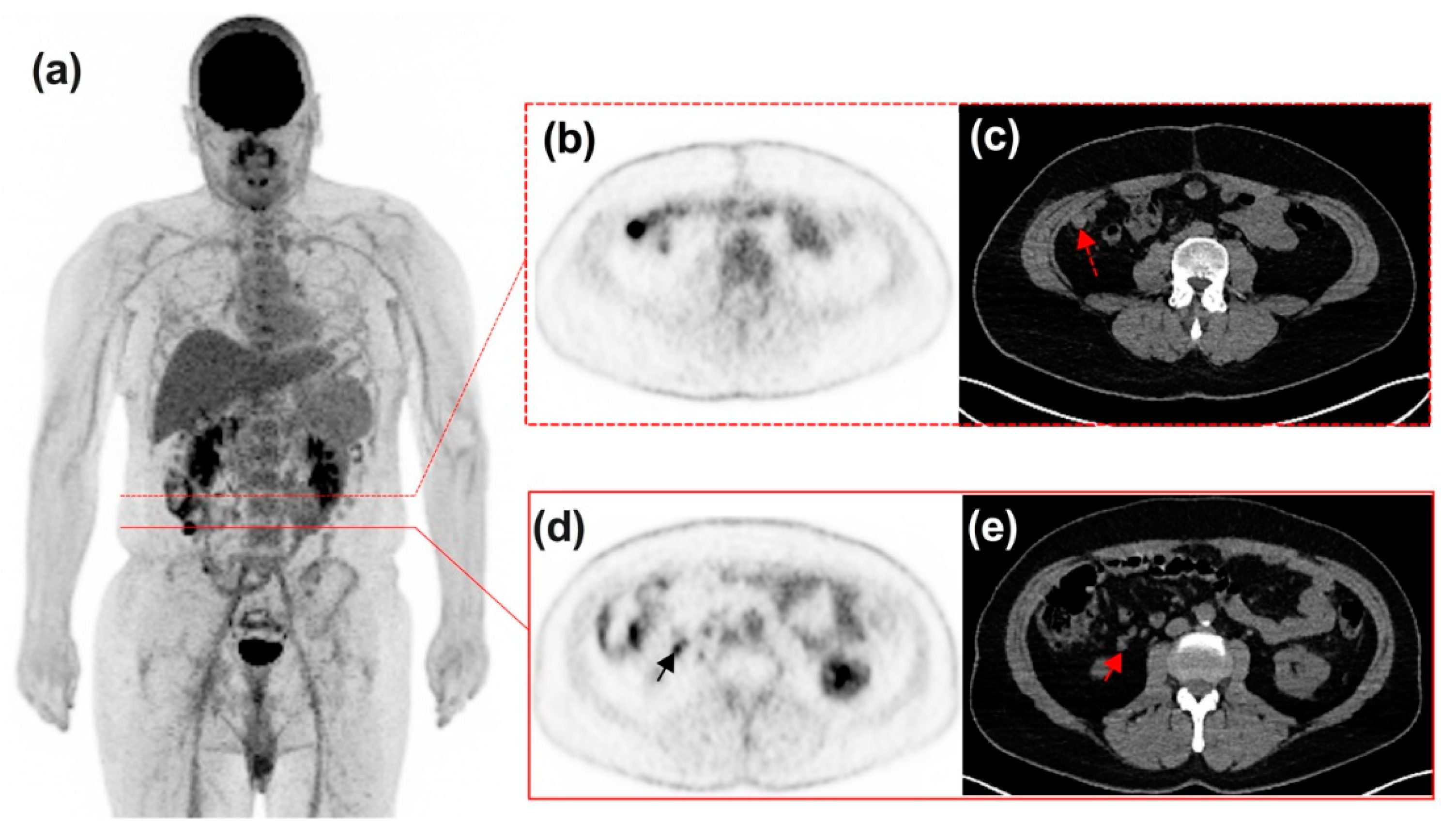 Diagnostics 11 01198 g008