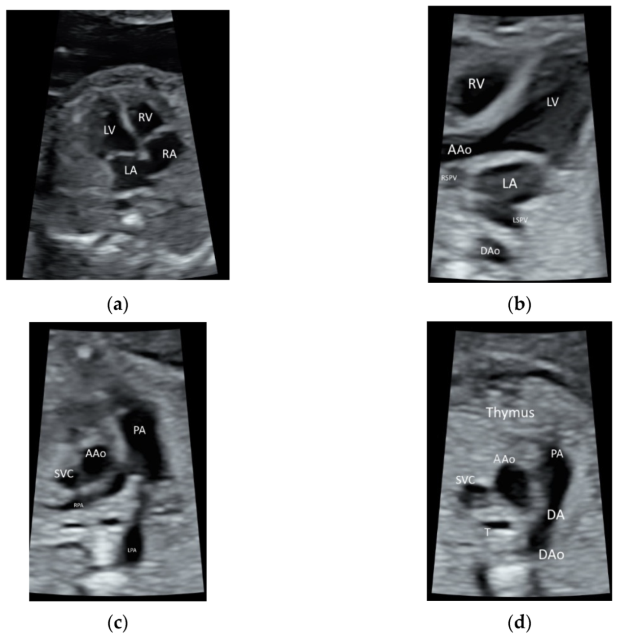 Diagnostics 11 01217 g001