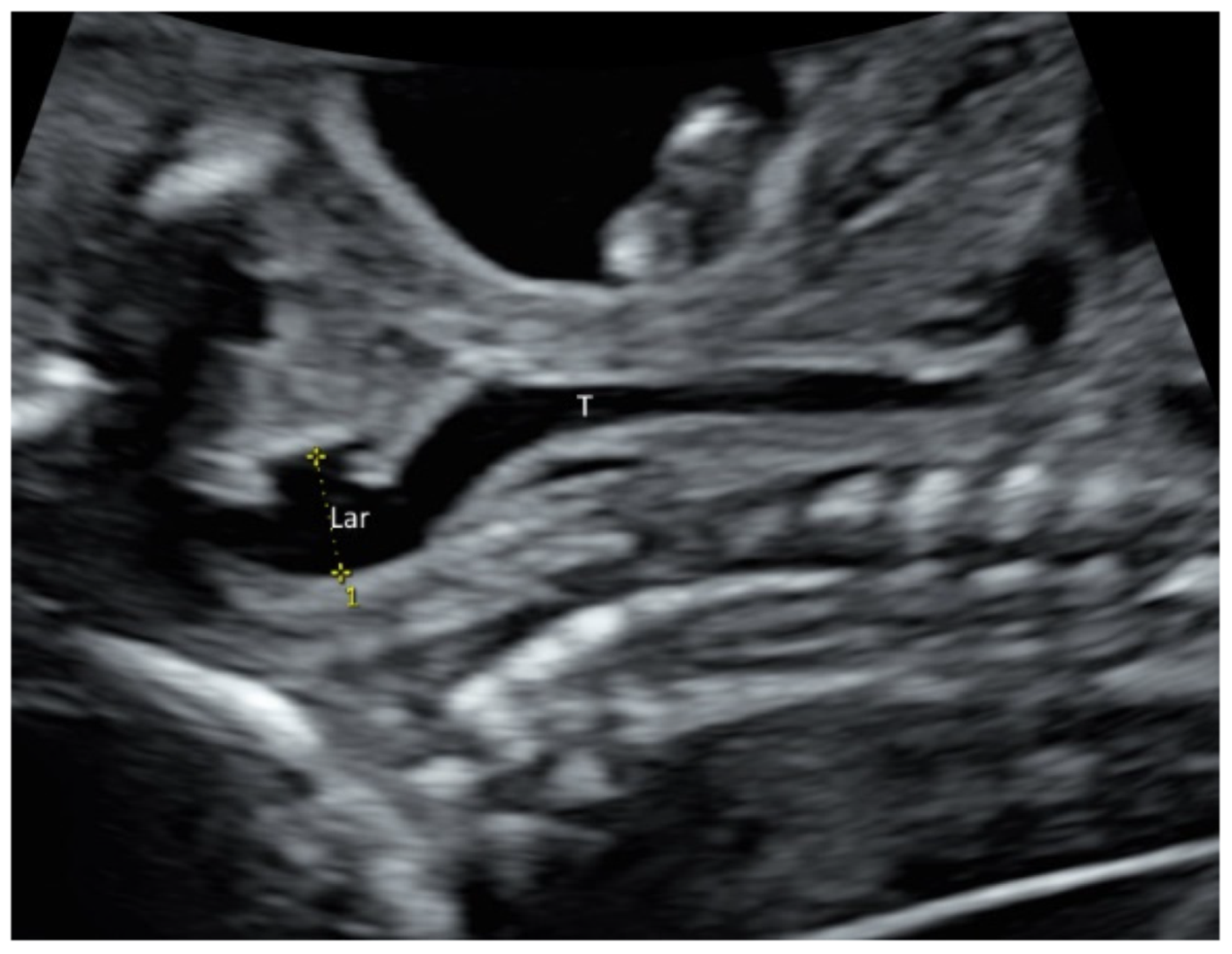 Diagnostics 11 01217 g004