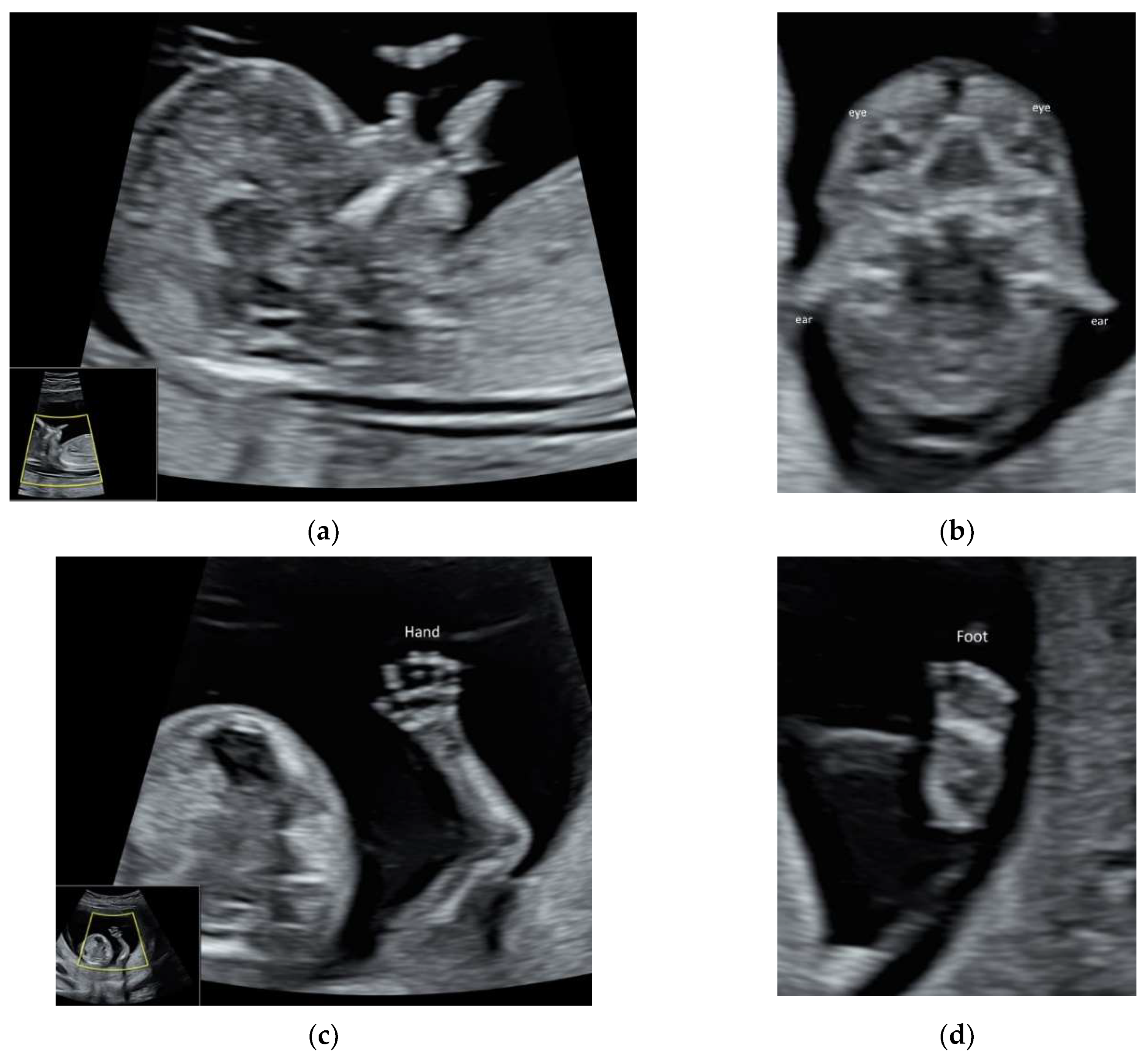 Diagnostics 11 01217 g005
