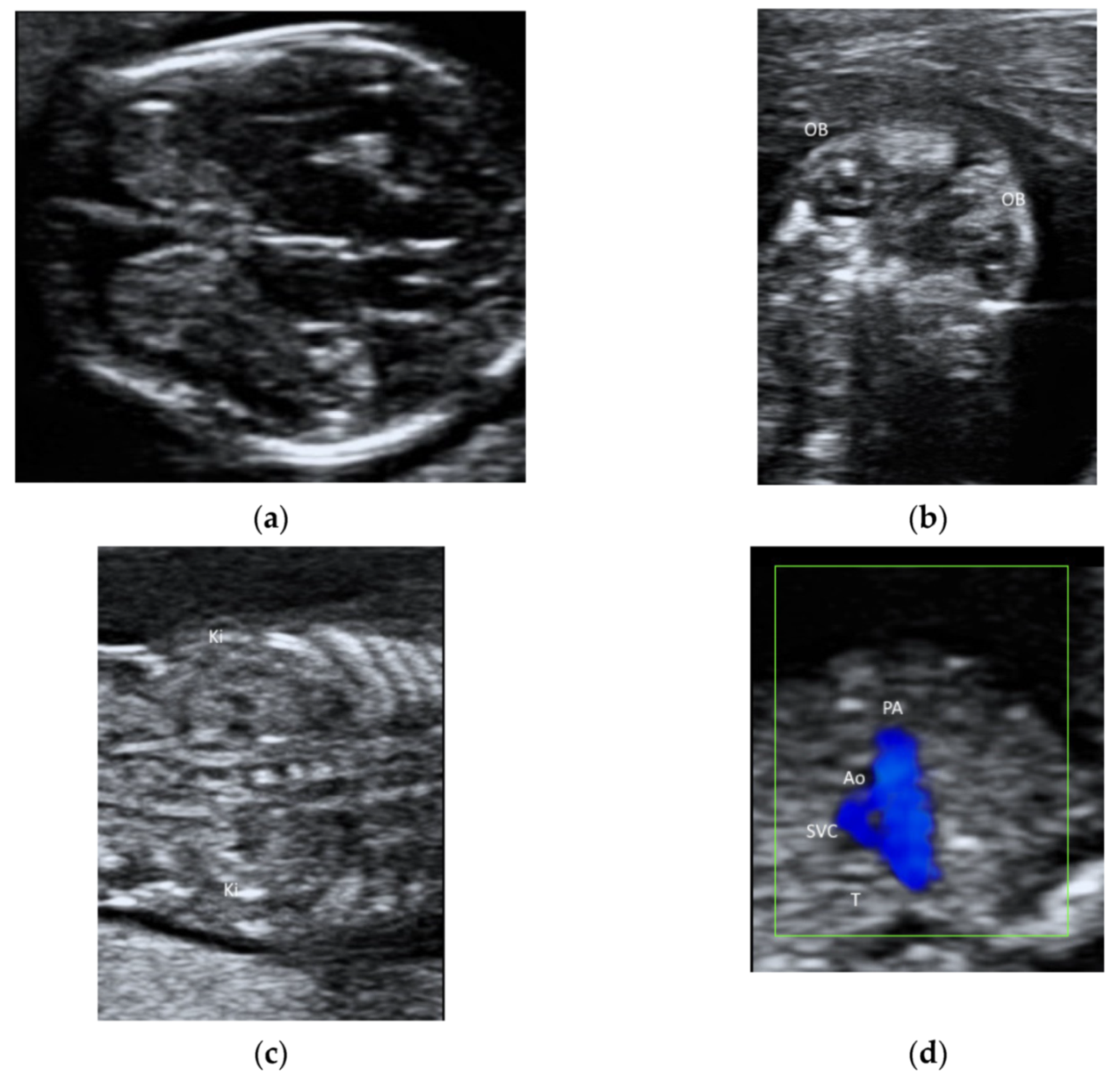 Diagnostics 11 01217 g006