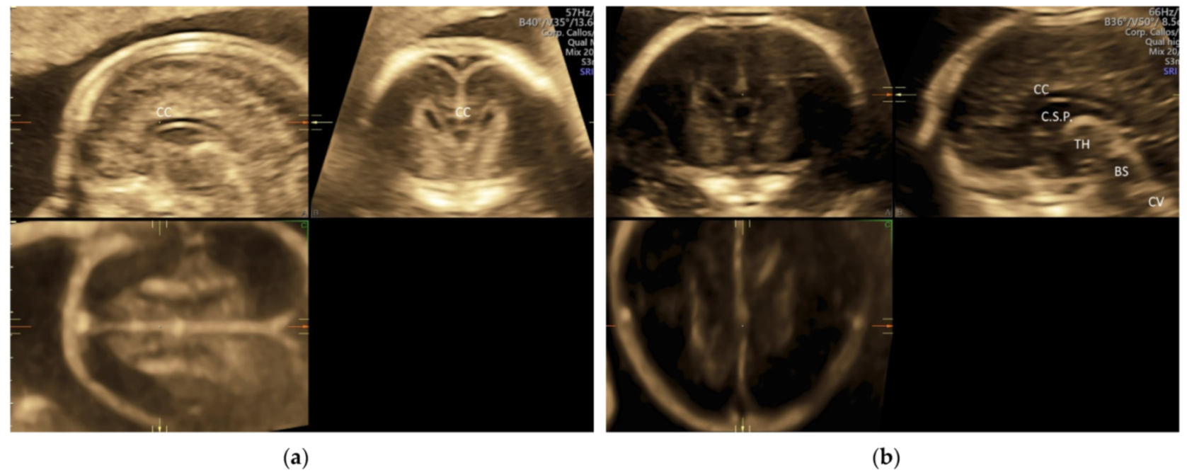 Diagnostics 11 01217 g007