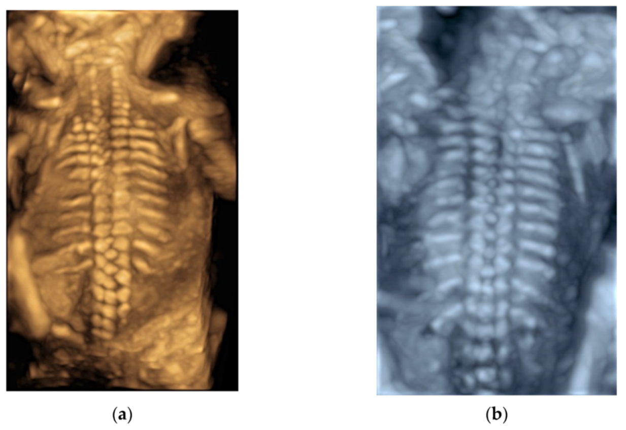 Diagnostics 11 01217 g008