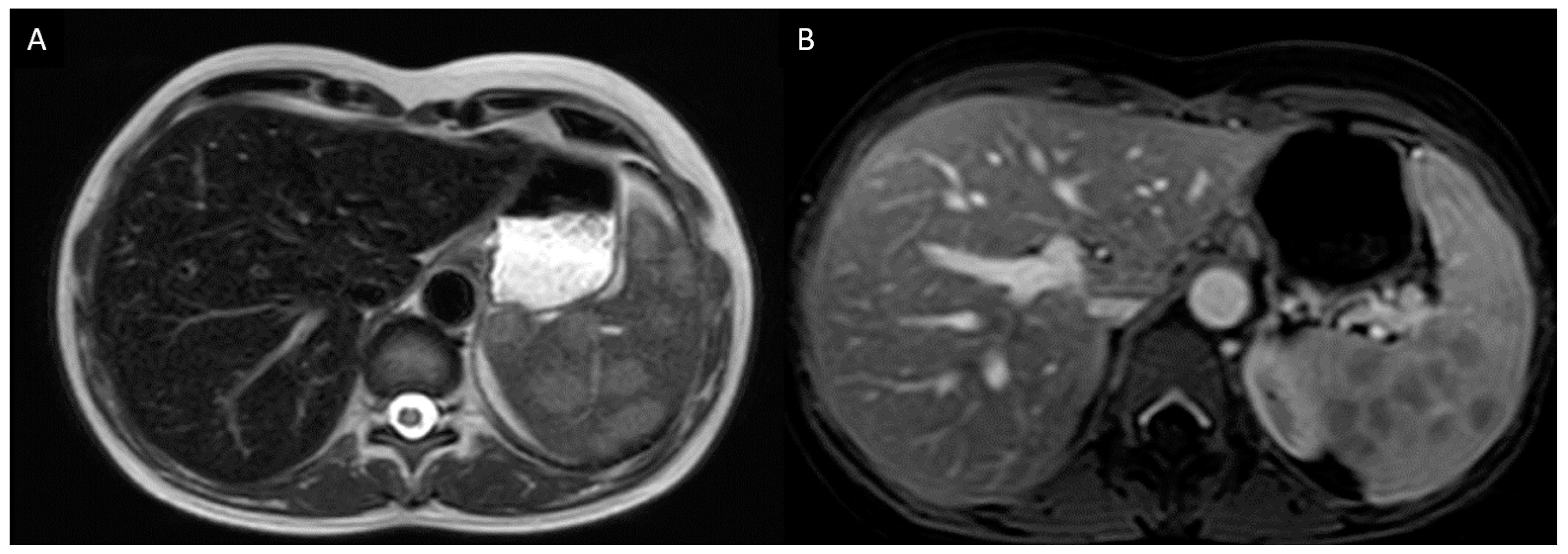 Diagnostics 11 01240 g001