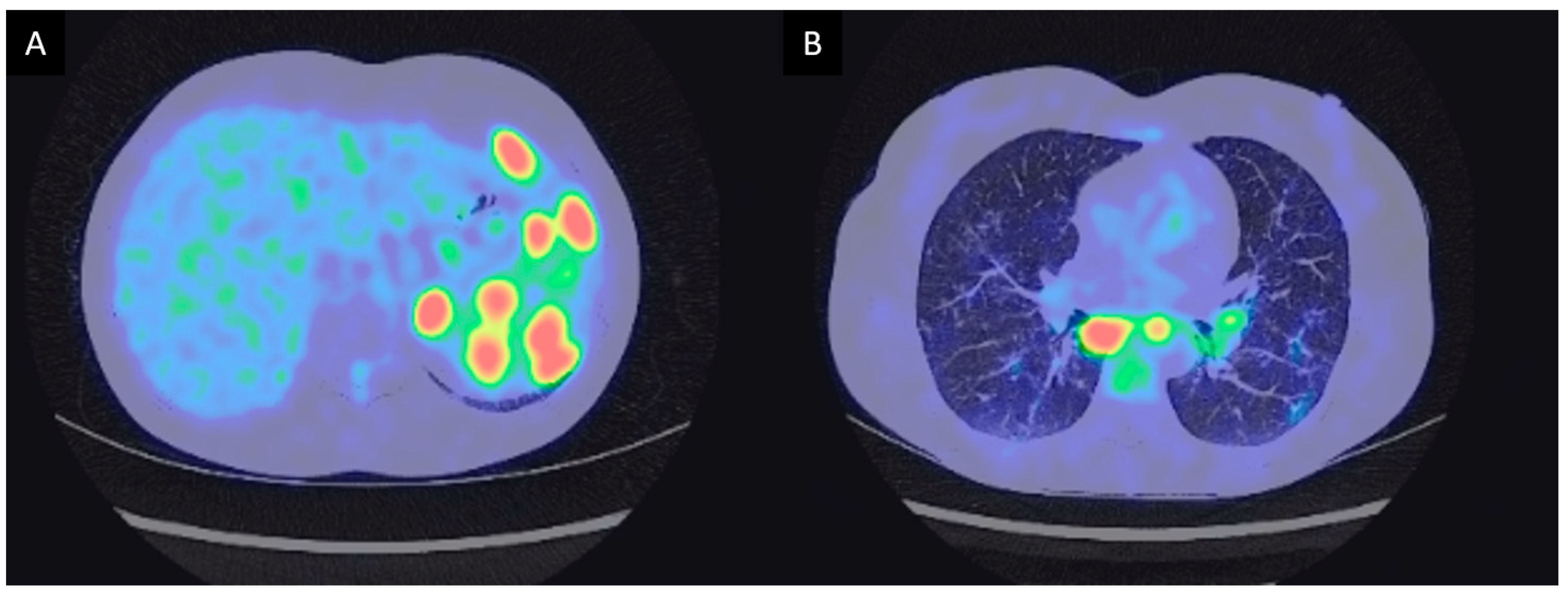 Diagnostics 11 01240 g002