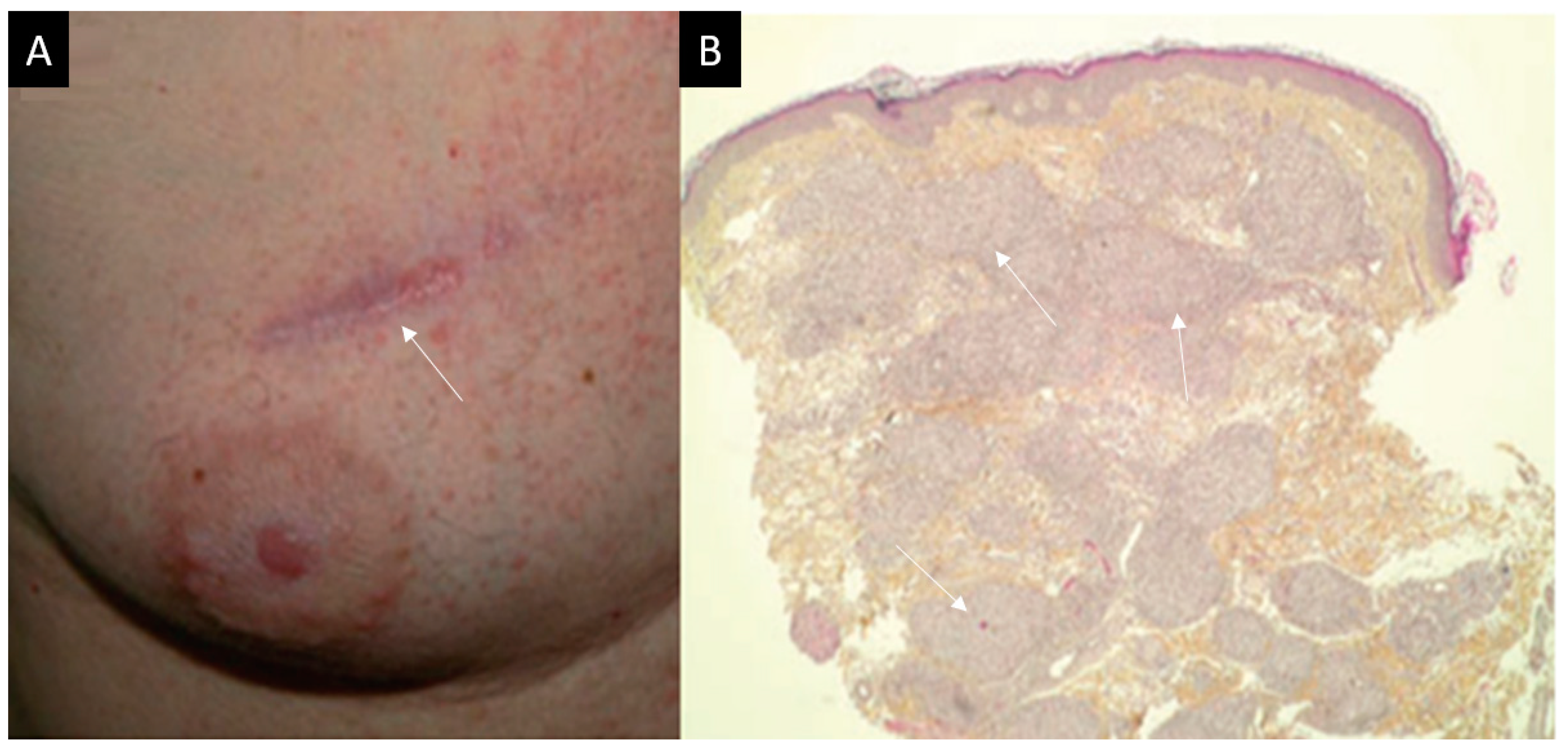 Diagnostics 11 01240 g003