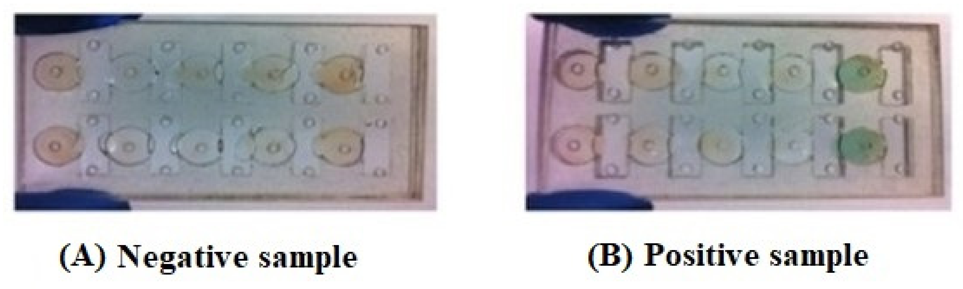 Diagnostics 11 01285 g003 Diagnostics 11 01285 g003