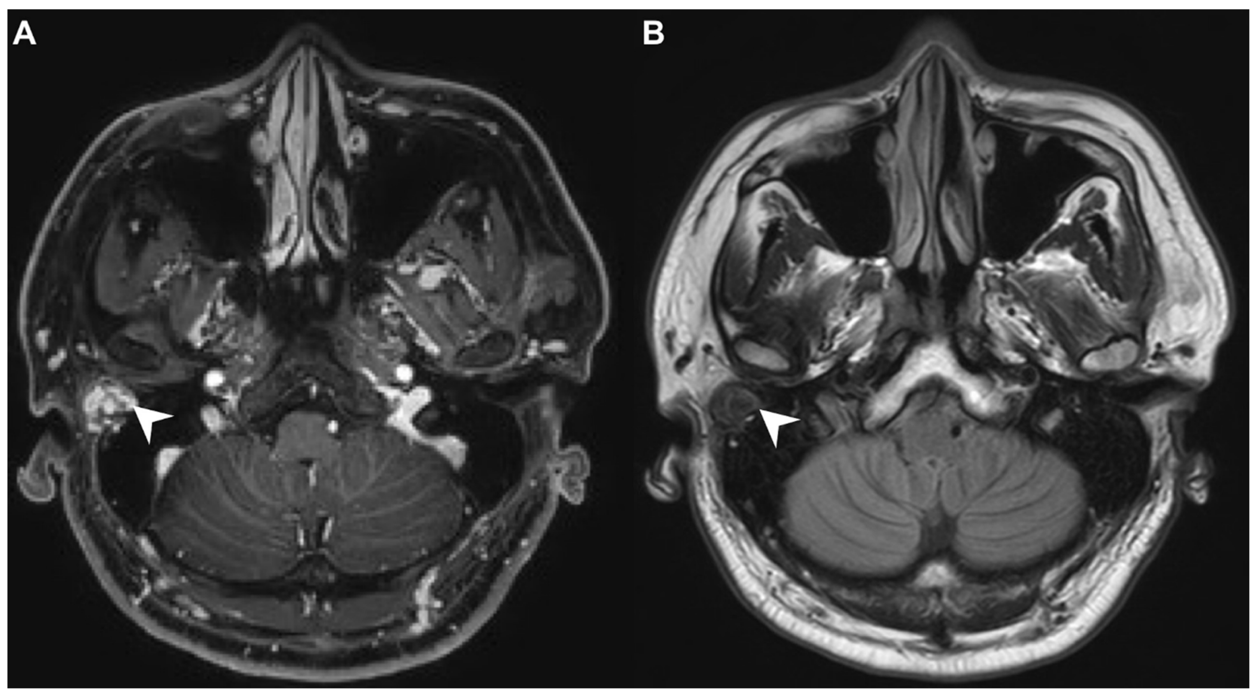 Diagnostics 11 01312 g003