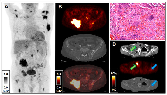 Diagnostics 11 01355 g001 550
