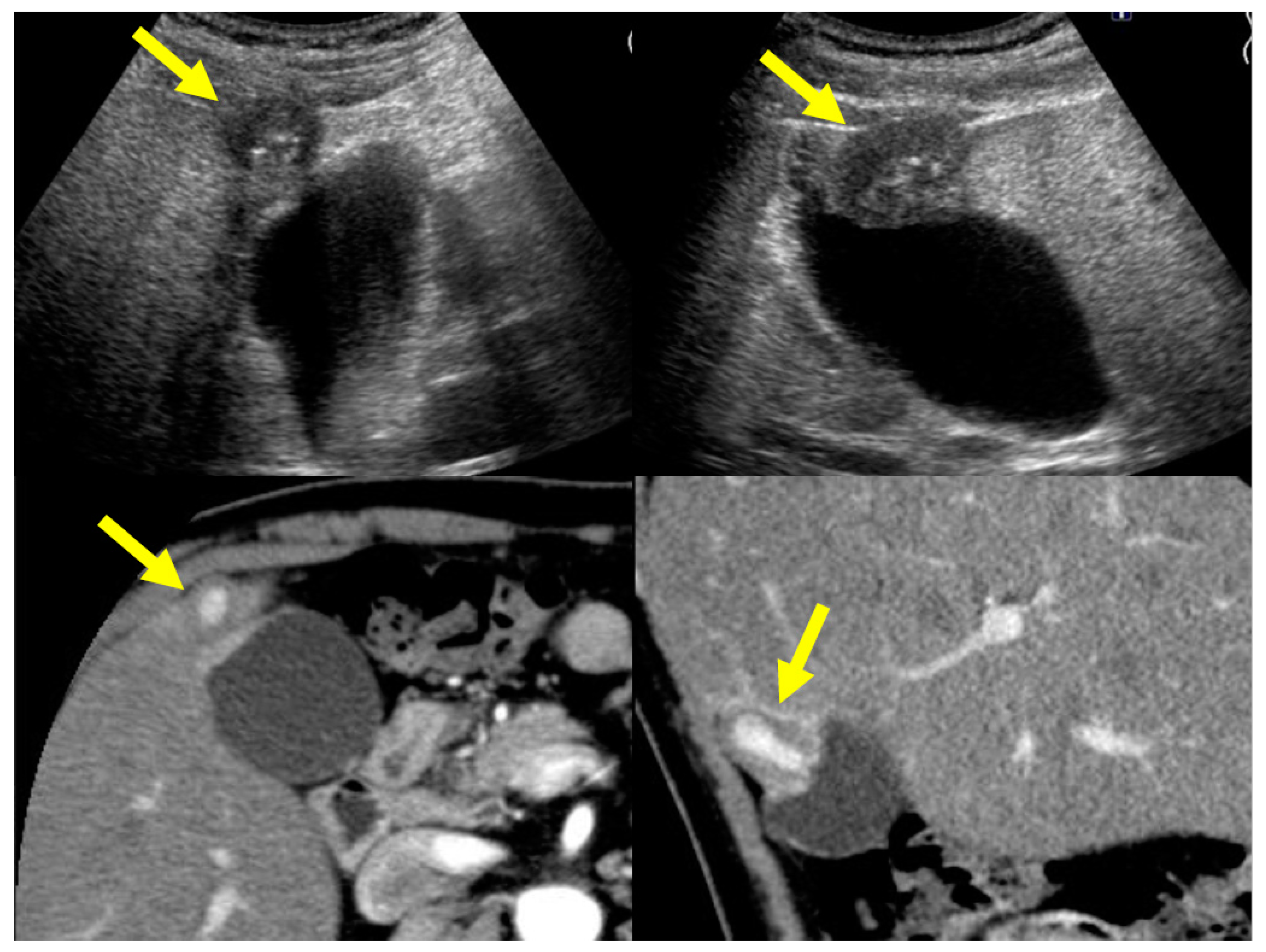 Diagnostics 11 01358 g008