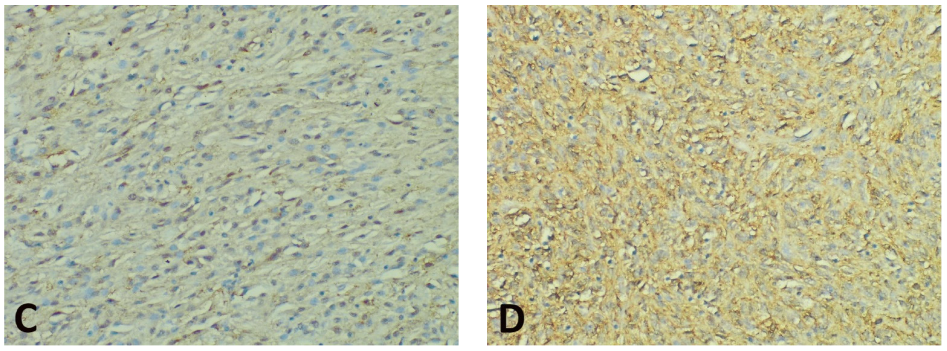 Diagnostics 11 01361 g003b Diagnostics 11 01361 g003b