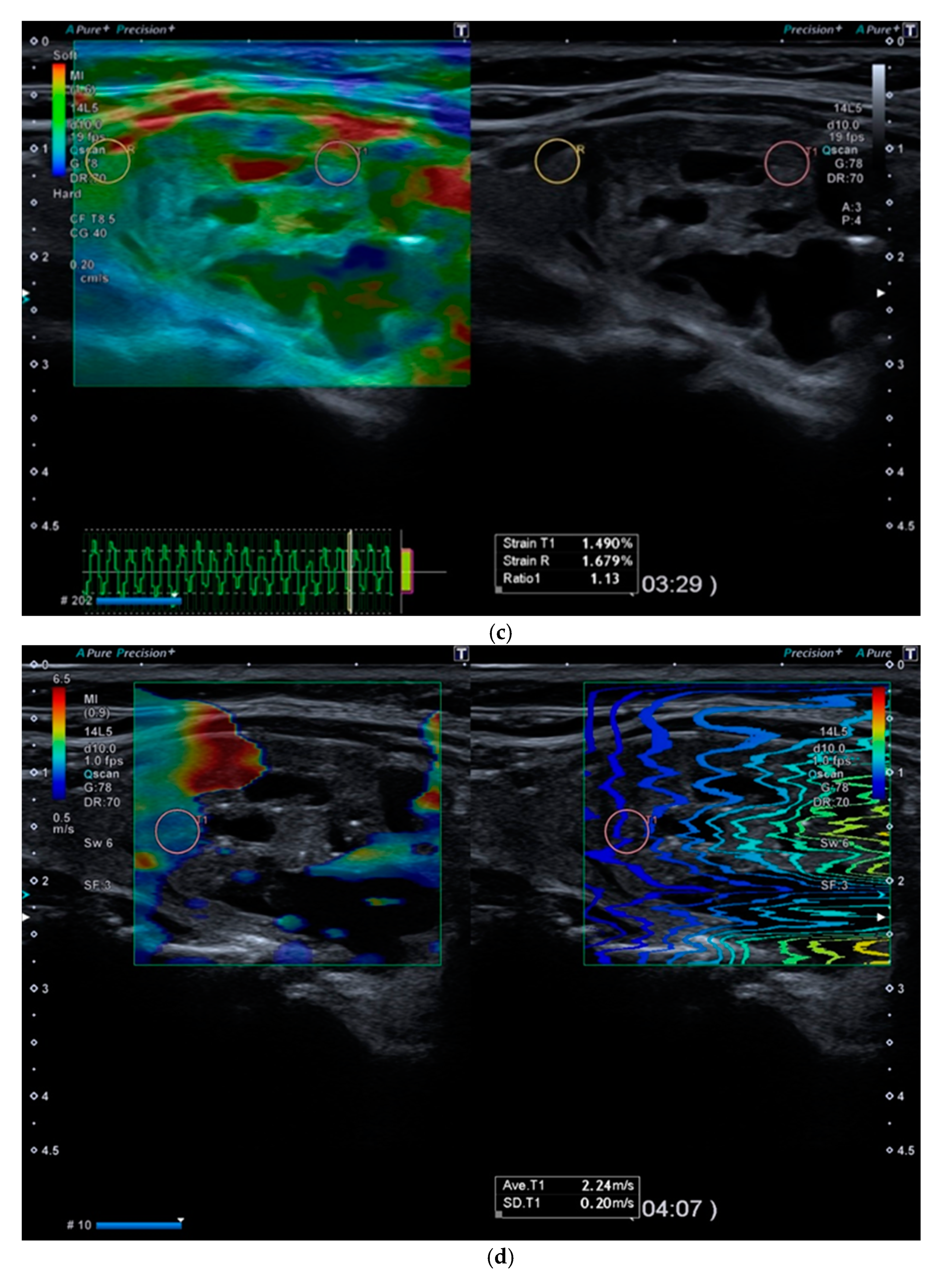 Diagnostics 11 01374 g002b Diagnostics 11 01374 g002b