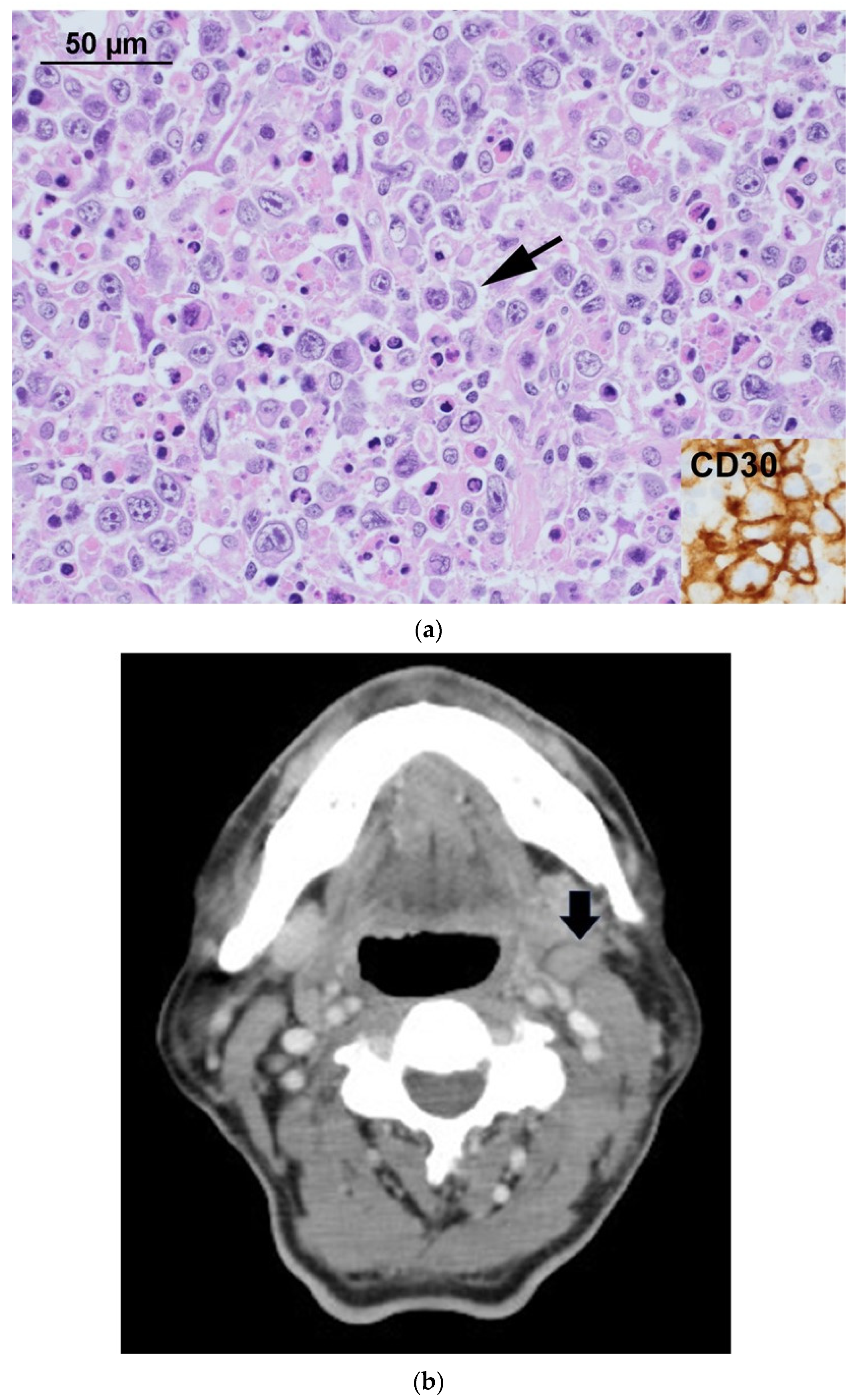 Diagnostics 11 01387 g001a