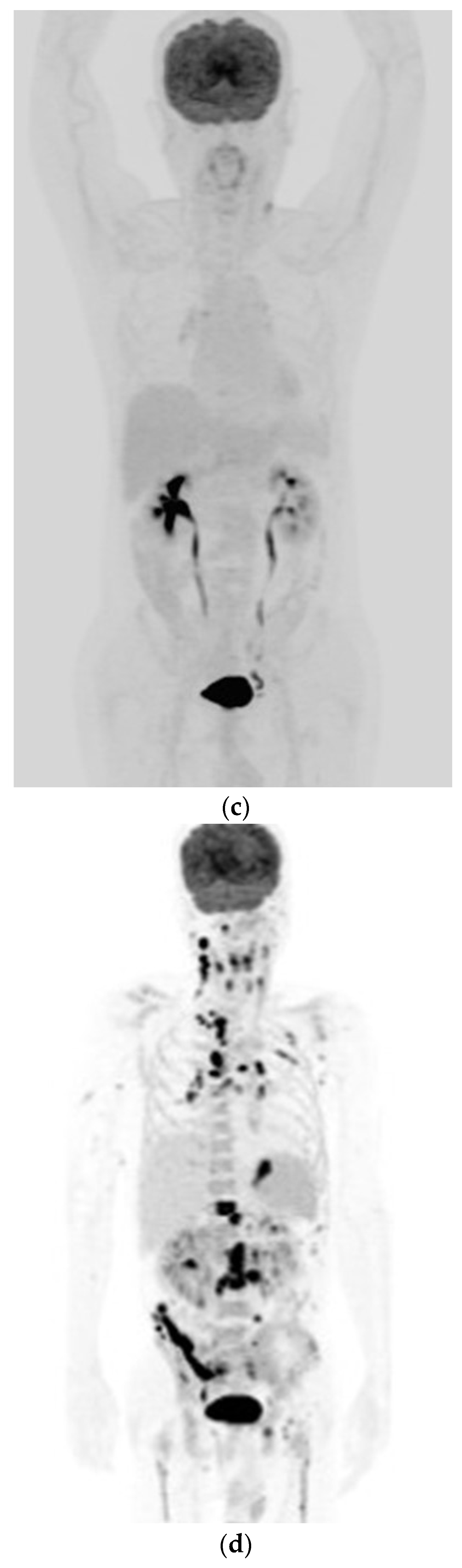 Diagnostics 11 01387 g001b