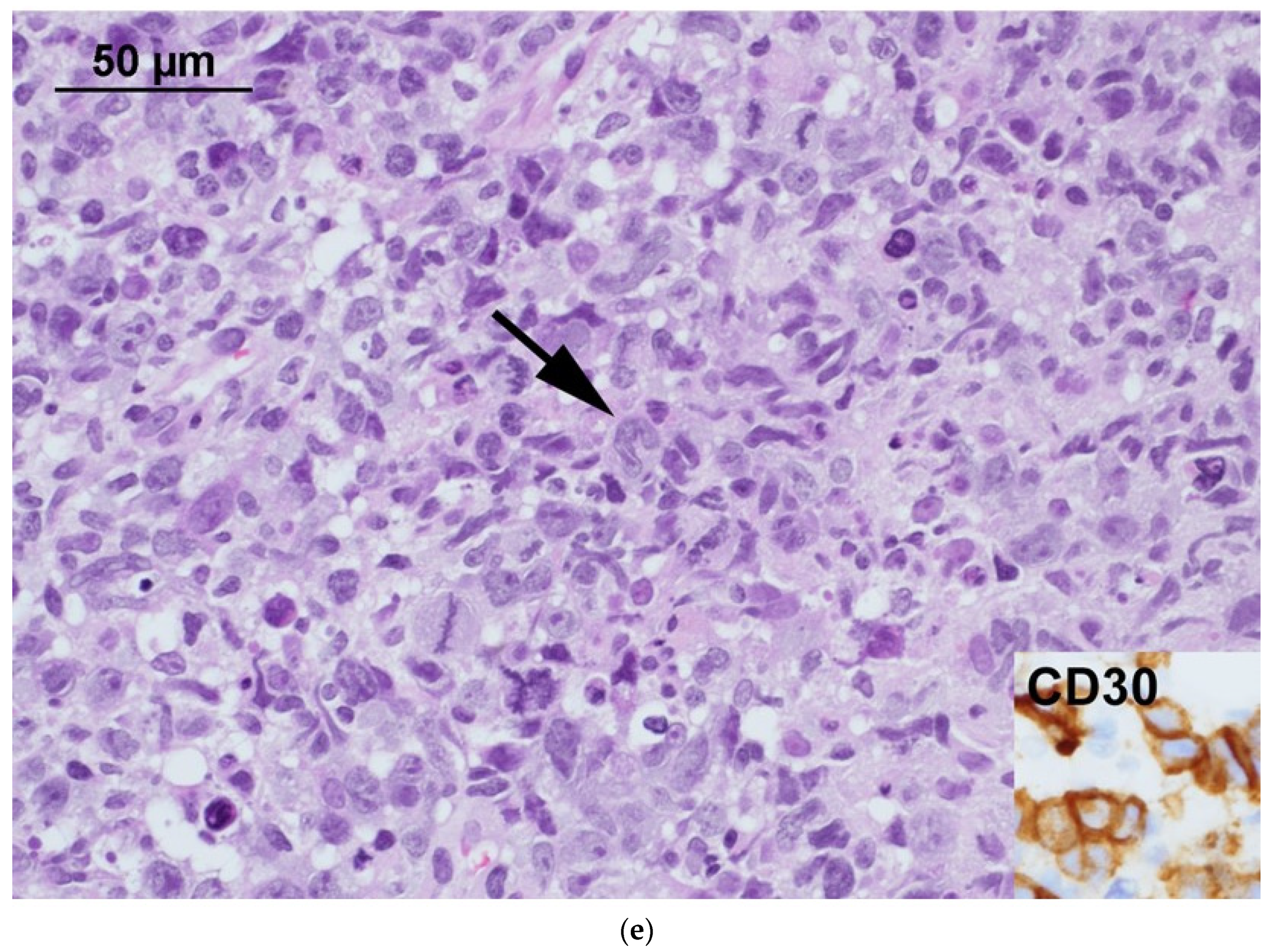 Diagnostics 11 01387 g001c