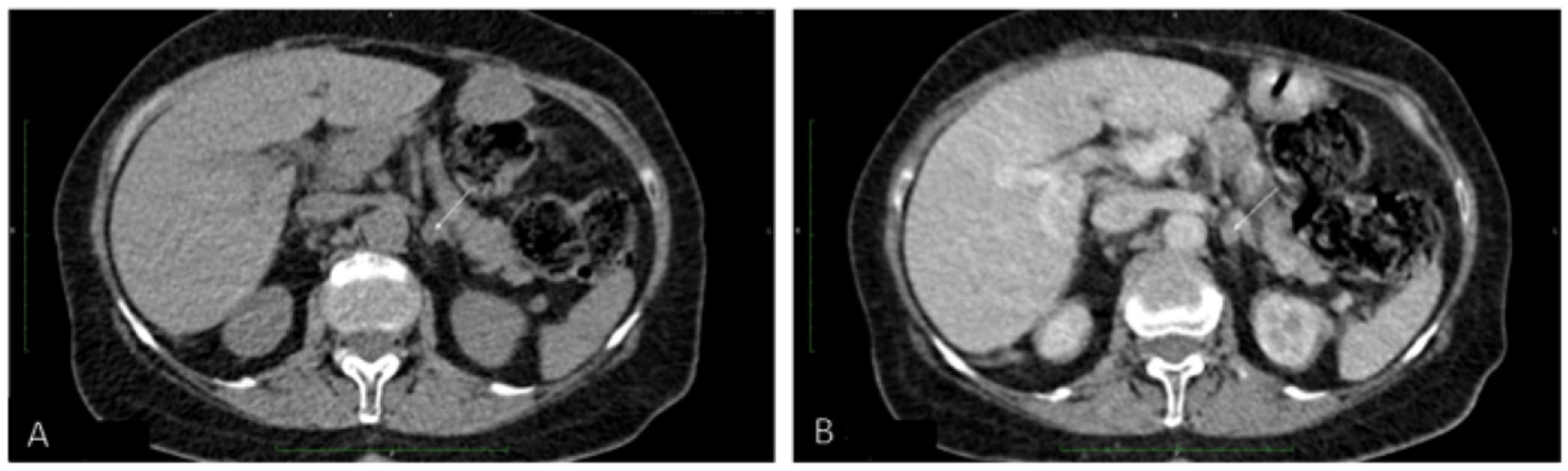 Diagnostics 11 01448 g003